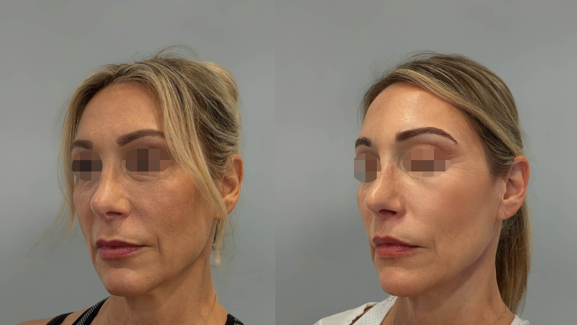 LMM_SideBySide – 67