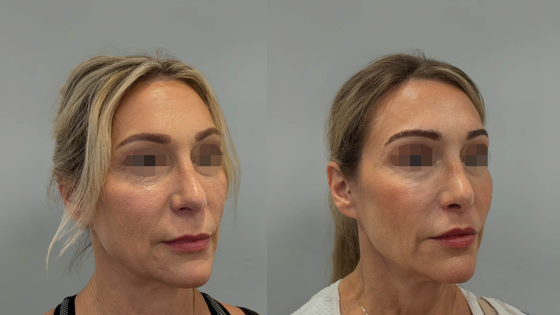 LMM_SideBySide – 67