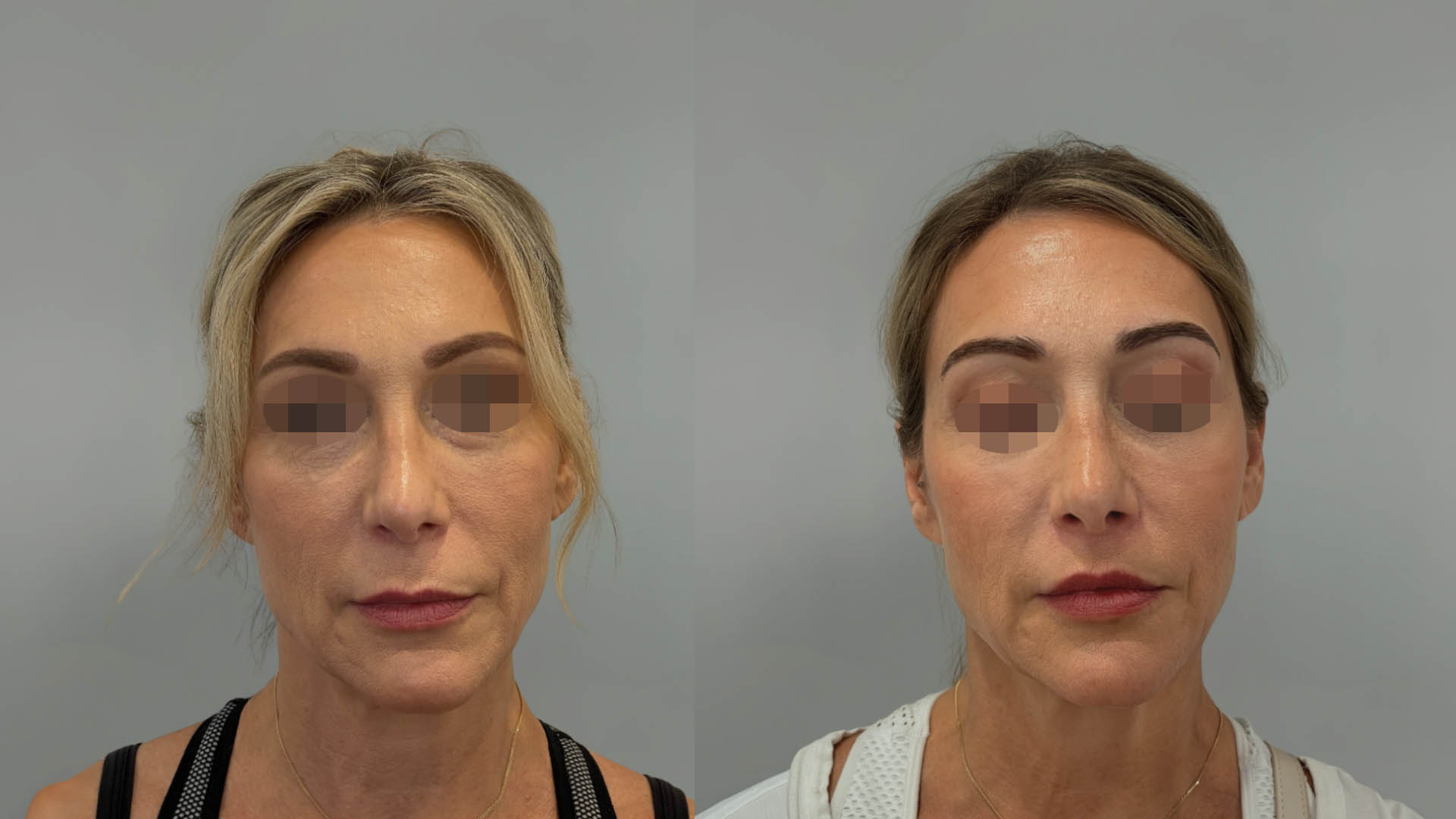 LMM_SideBySide – 67