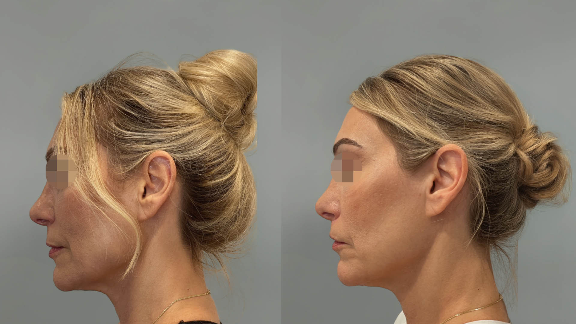 LMM_SideBySide – 67