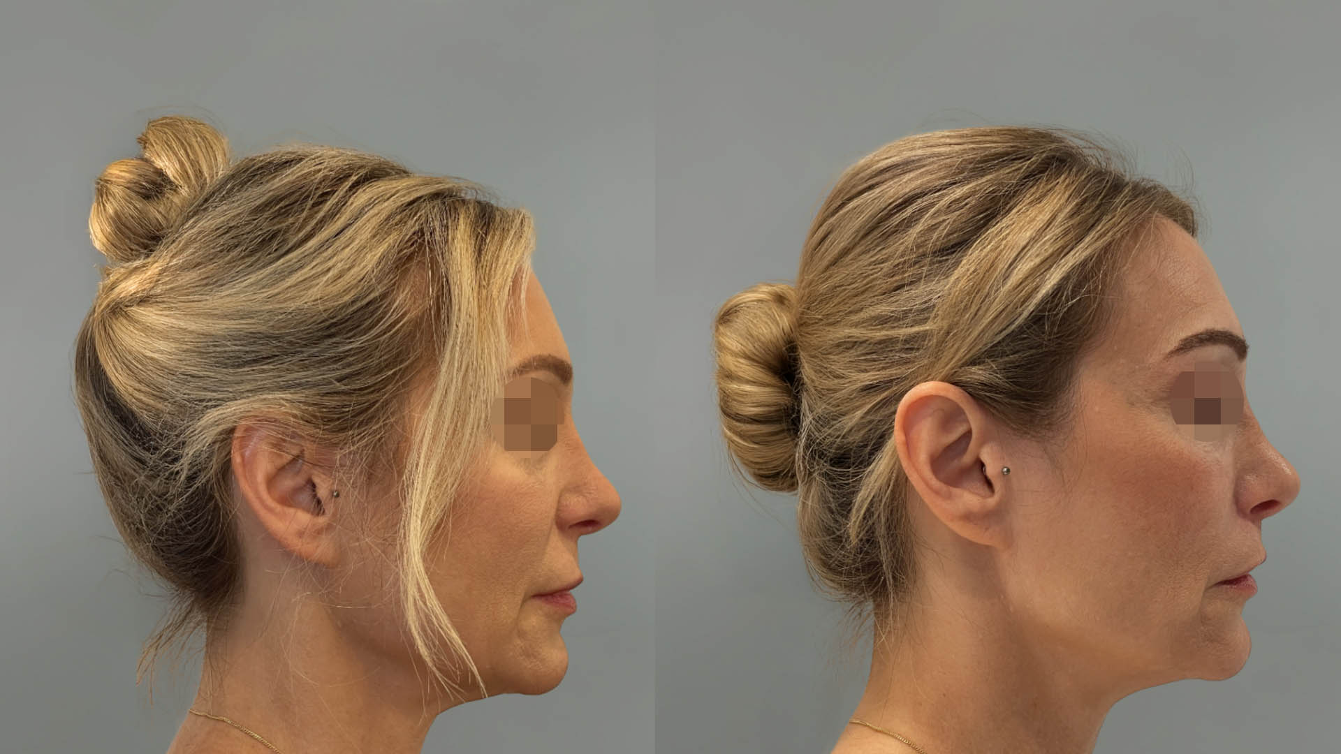 LMM_SideBySide – 67