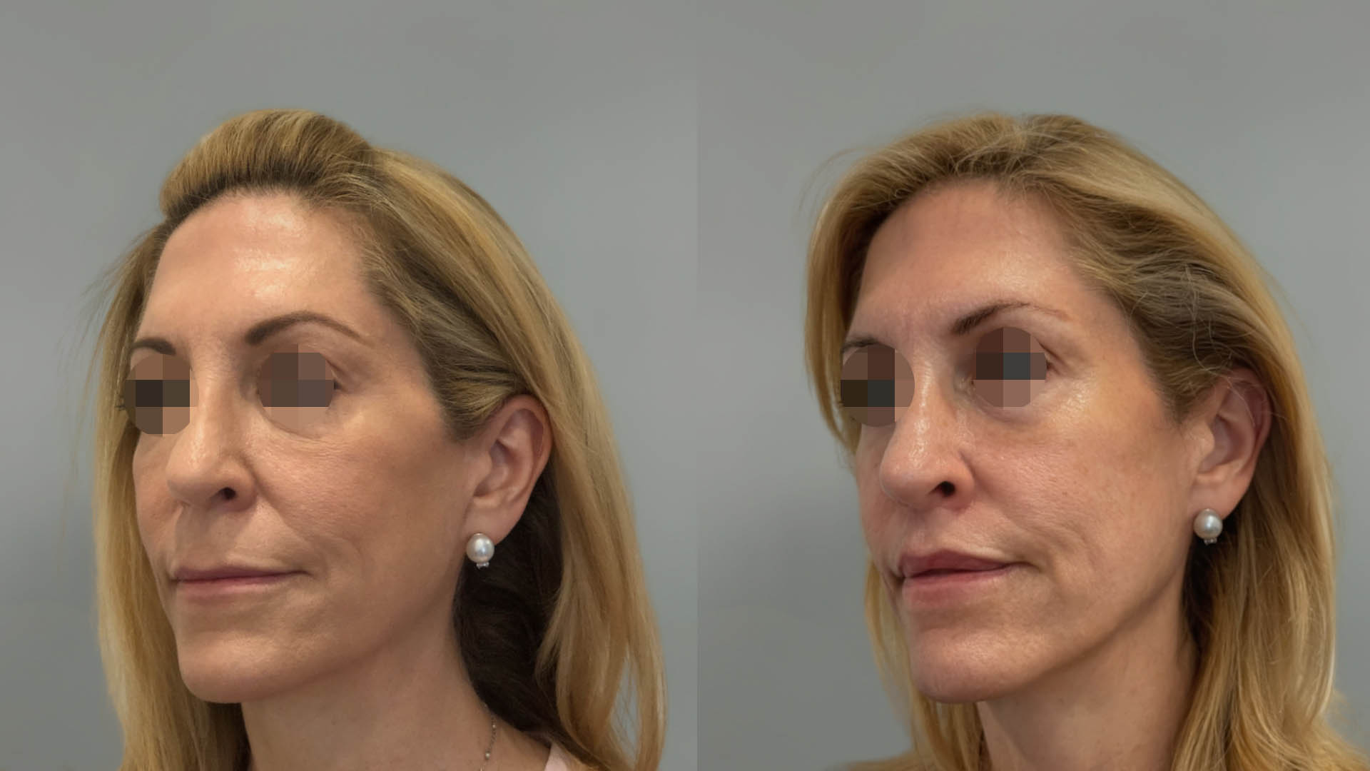 LMM_SideBySide – 67