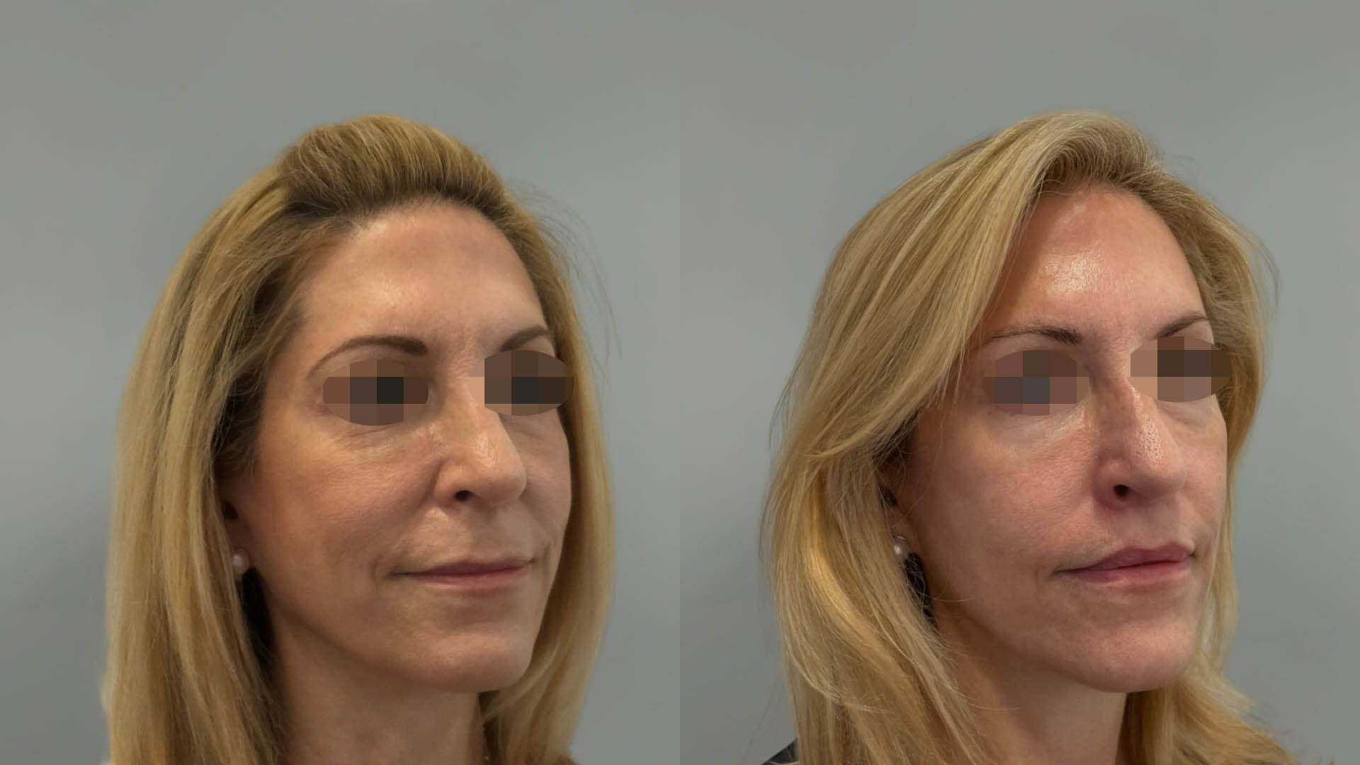 LMM_SideBySide – 67