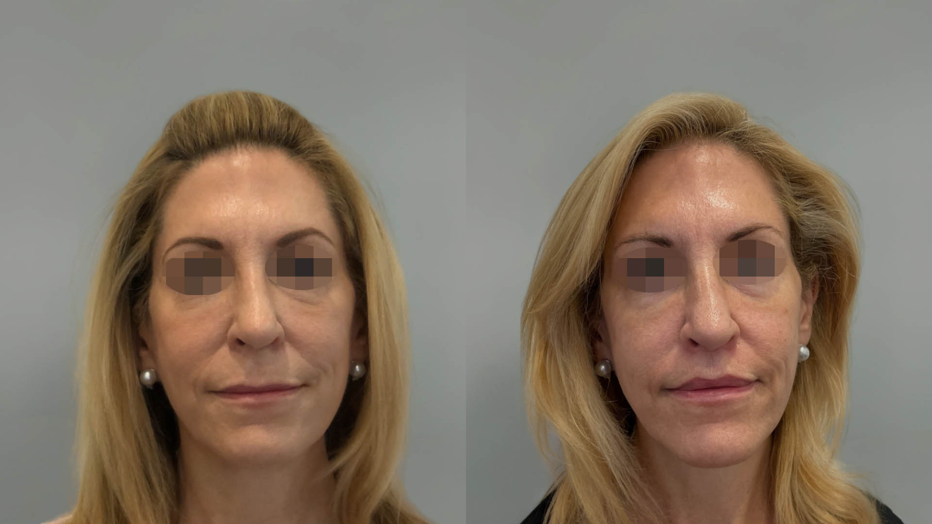 LMM_SideBySide – 67