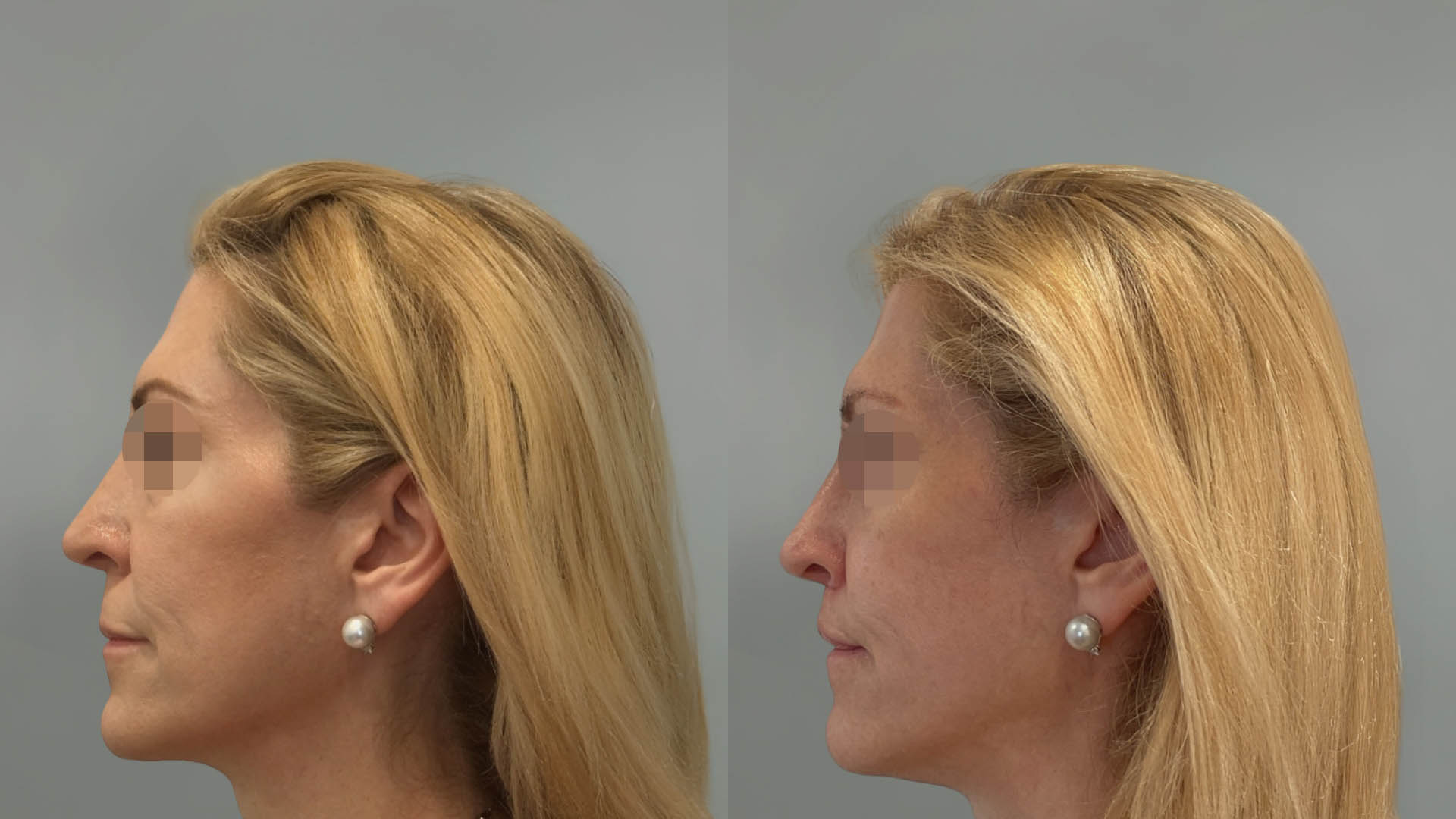 LMM_SideBySide – 67