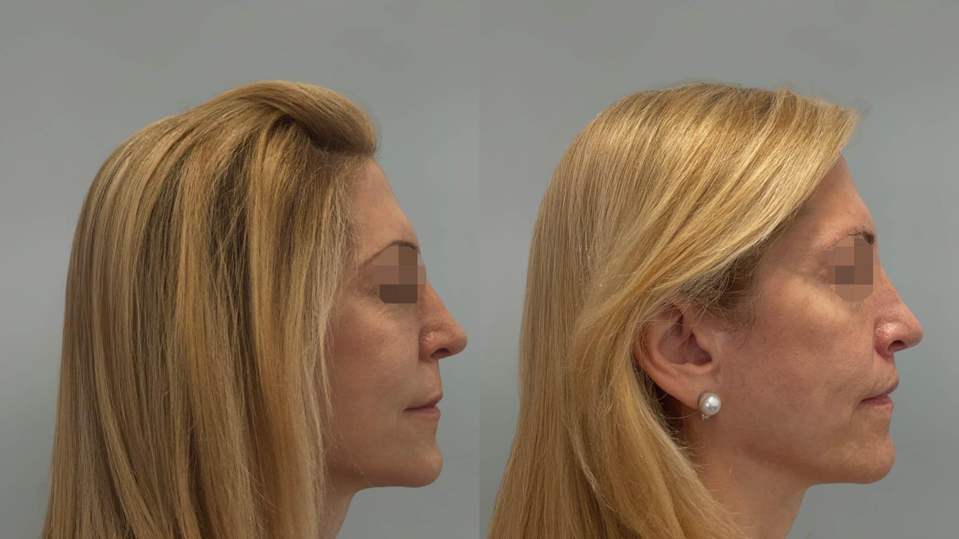 LMM_SideBySide – 67