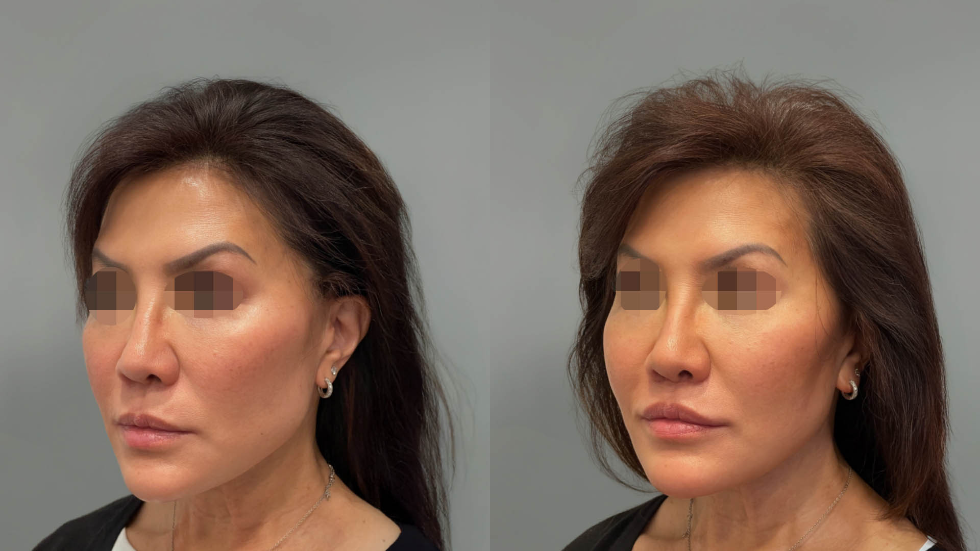 LMM_SideBySide – 67