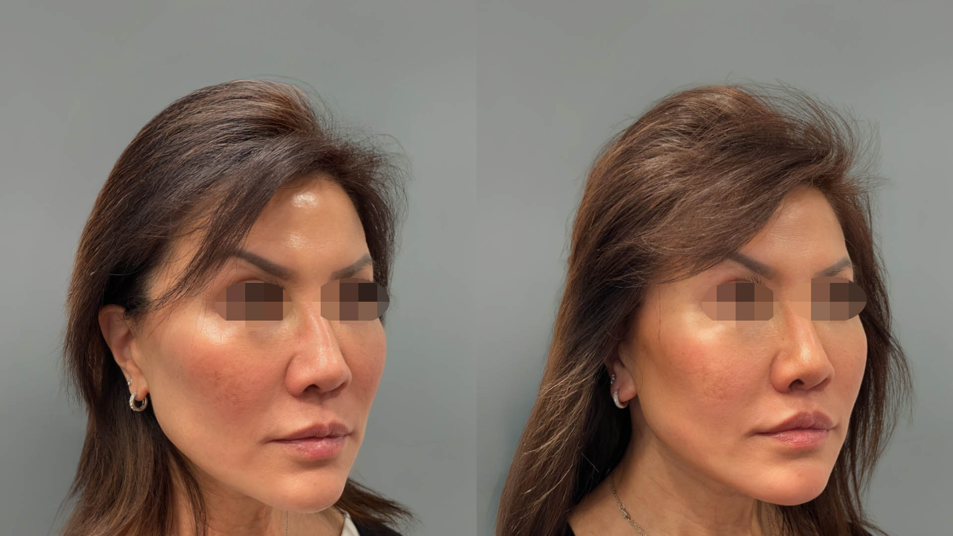 LMM_SideBySide – 67