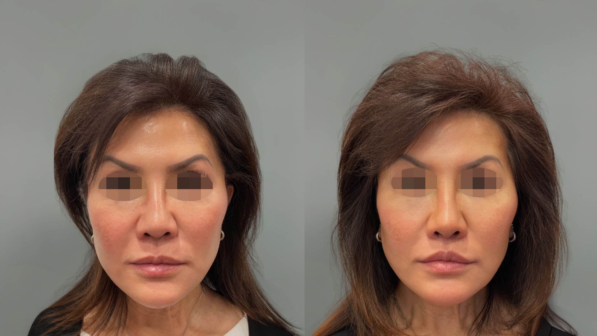 LMM_SideBySide – 67