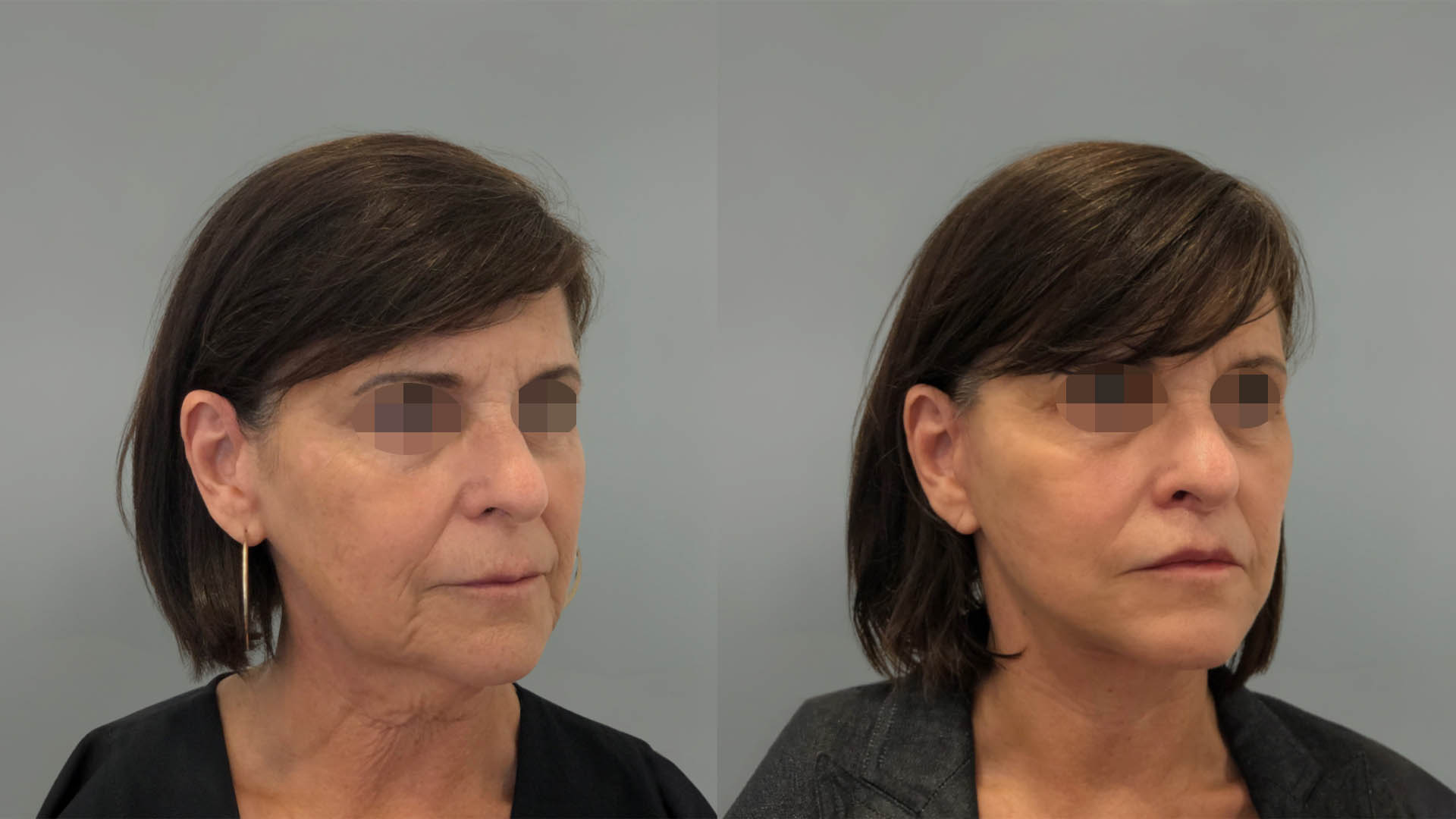 LMM_SideBySide – 67