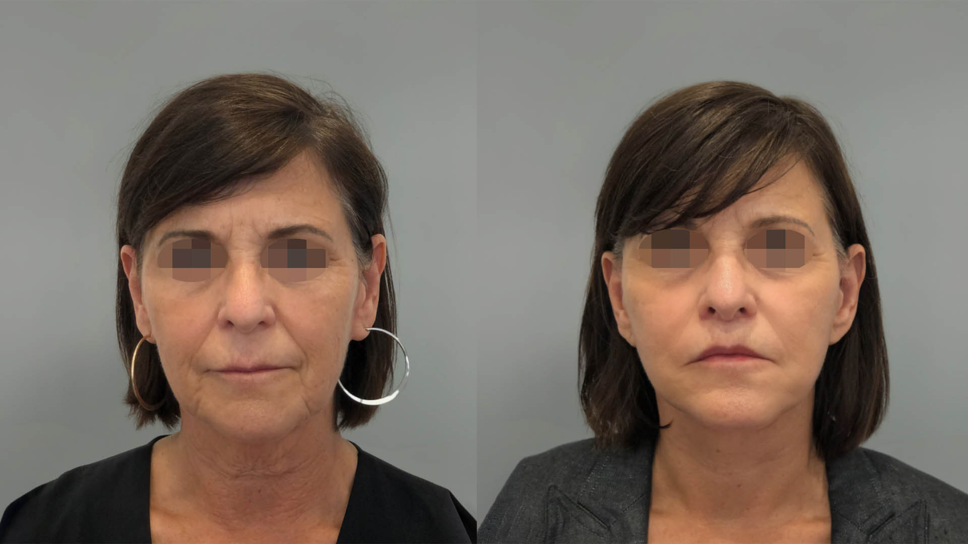 LMM_SideBySide – 67