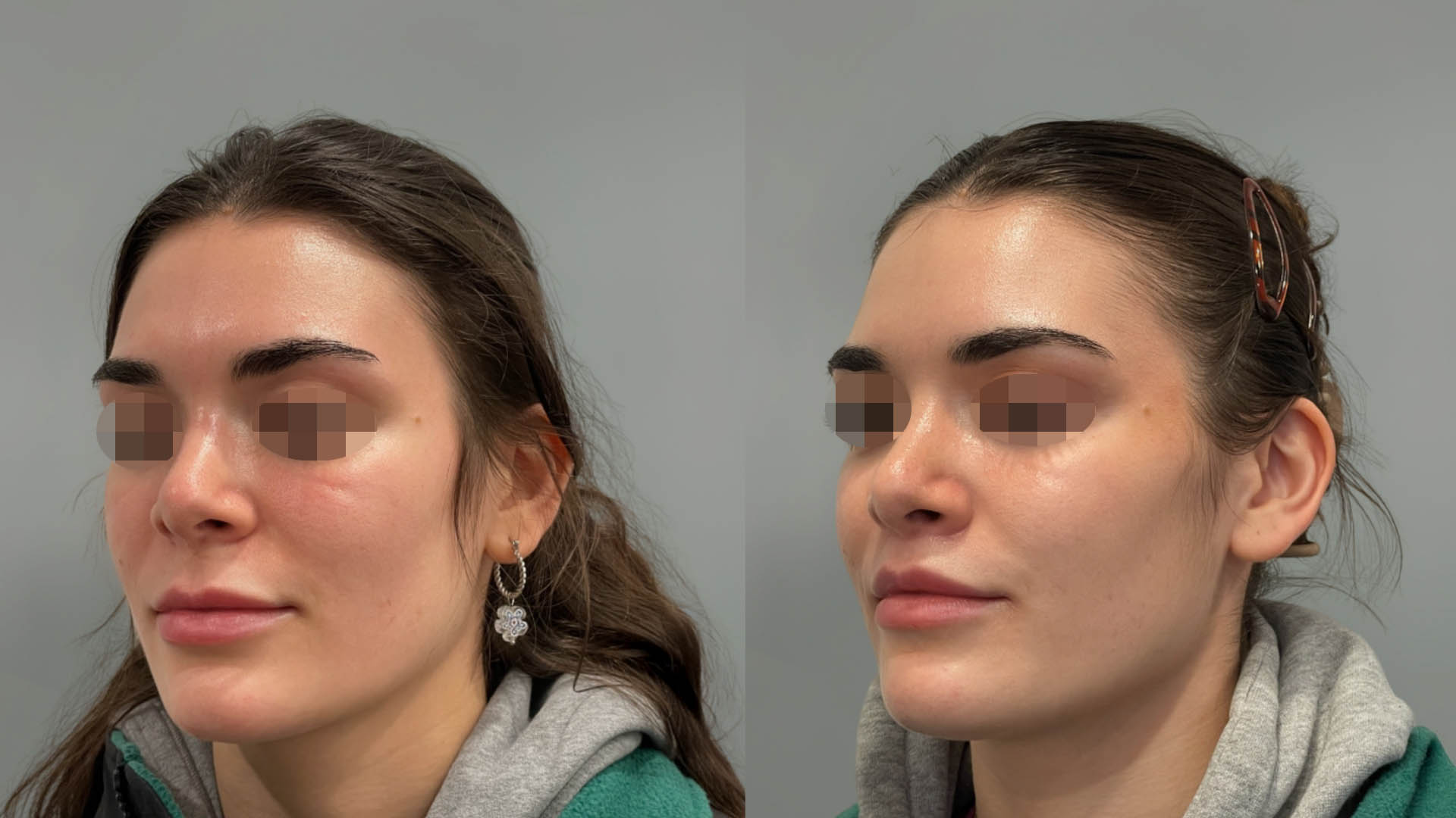 LMM_SideBySide – 67