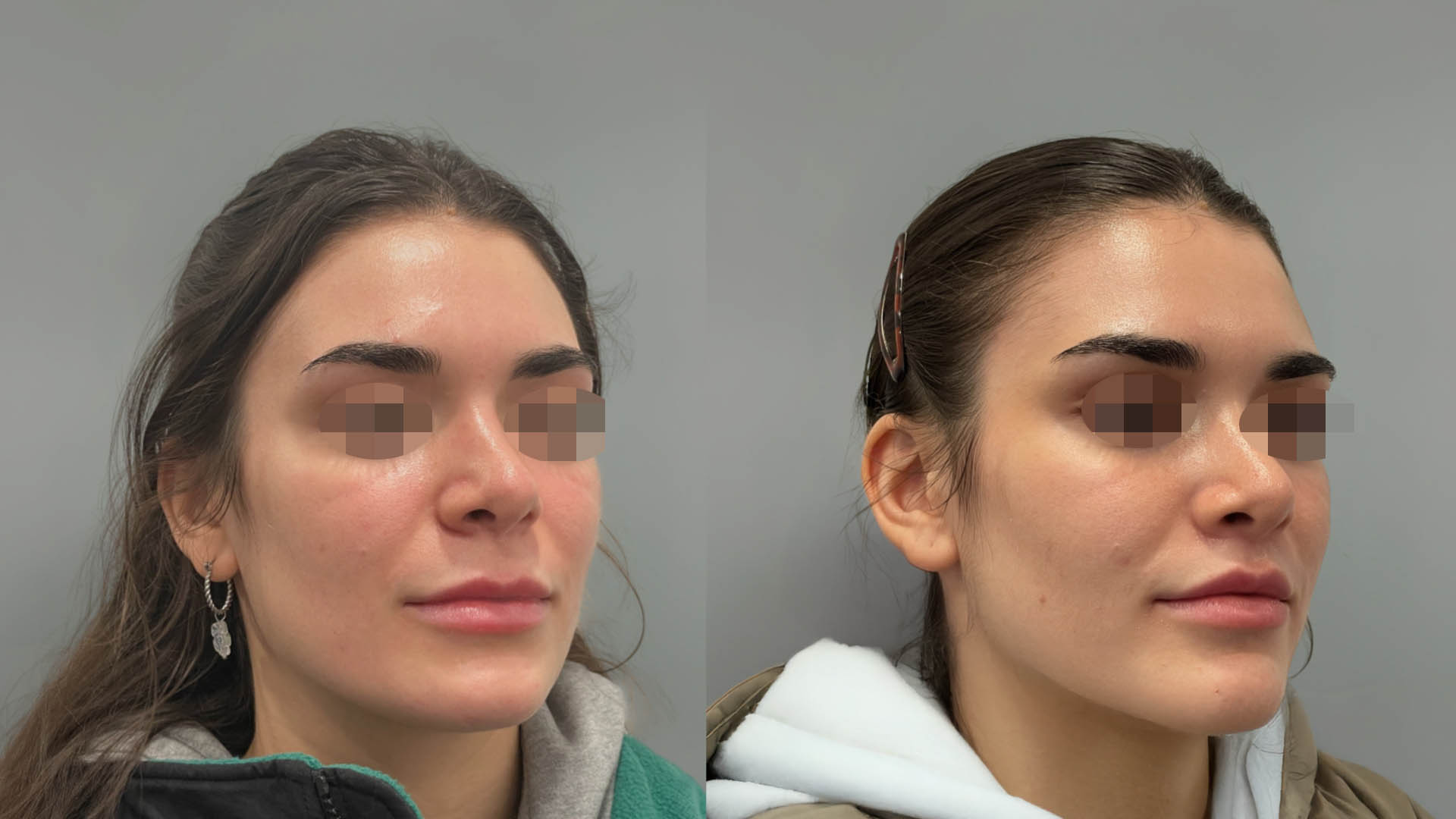 LMM_SideBySide – 67