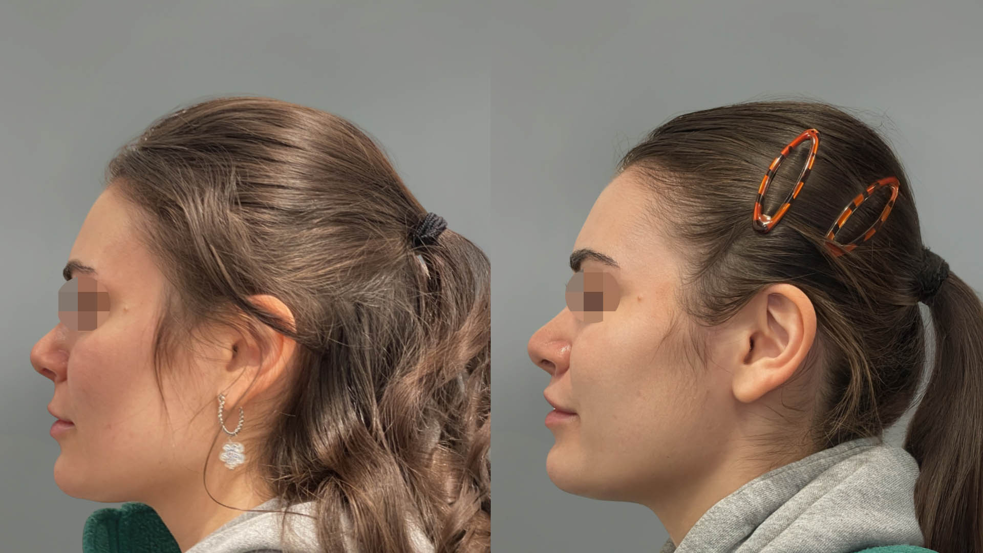 LMM_SideBySide – 67