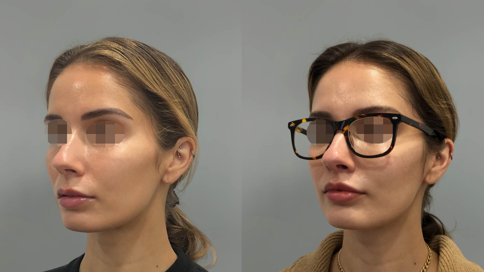 LMM_SideBySide – 67