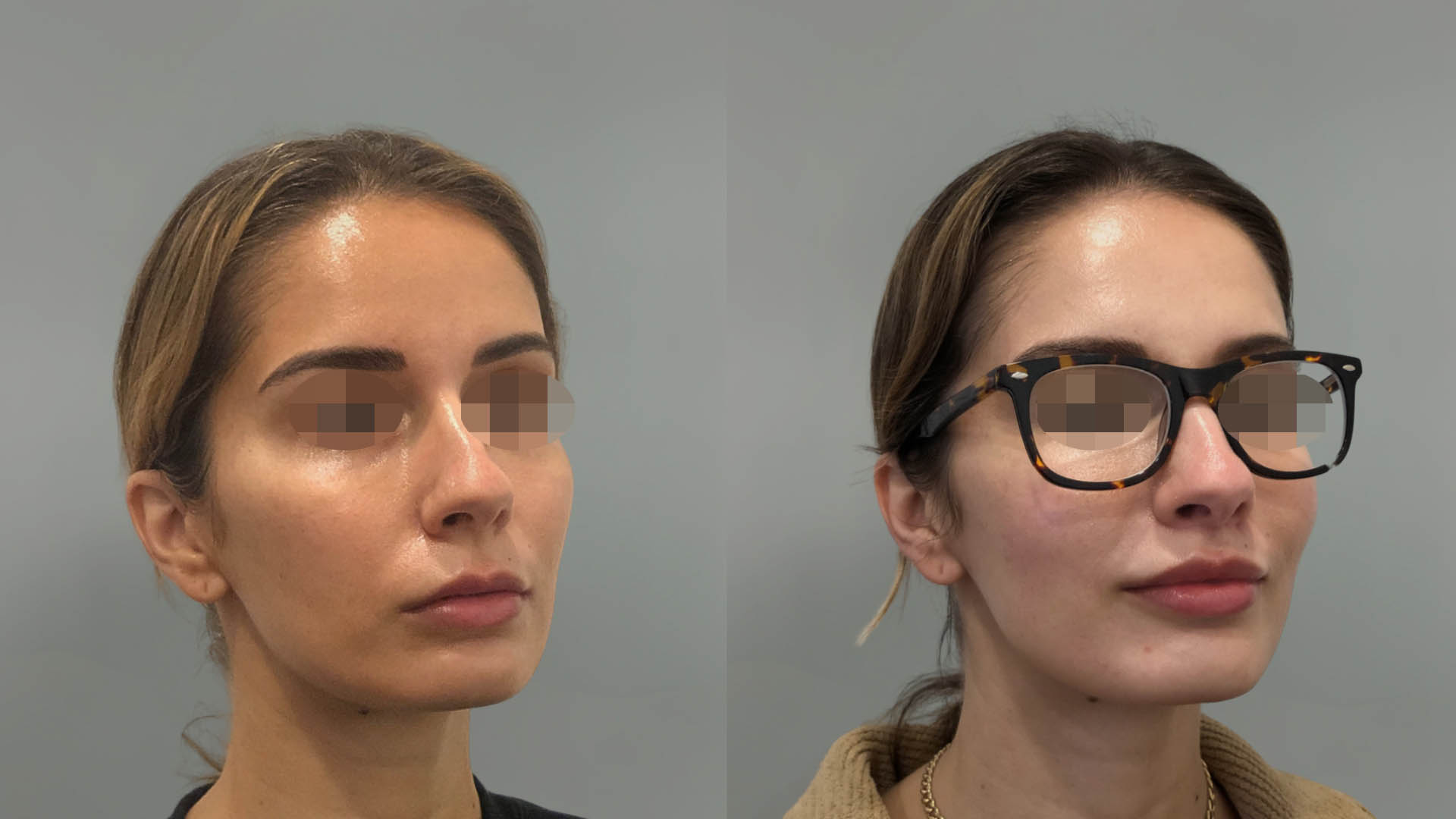 LMM_SideBySide – 67