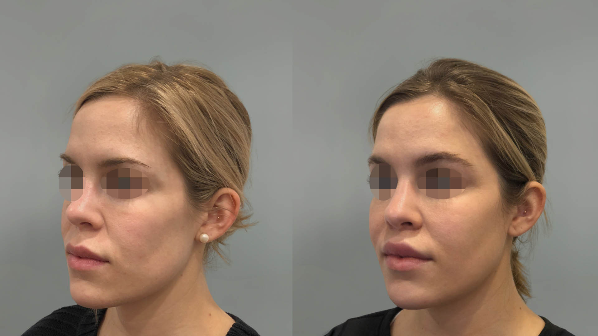 LMM_SideBySide – 67