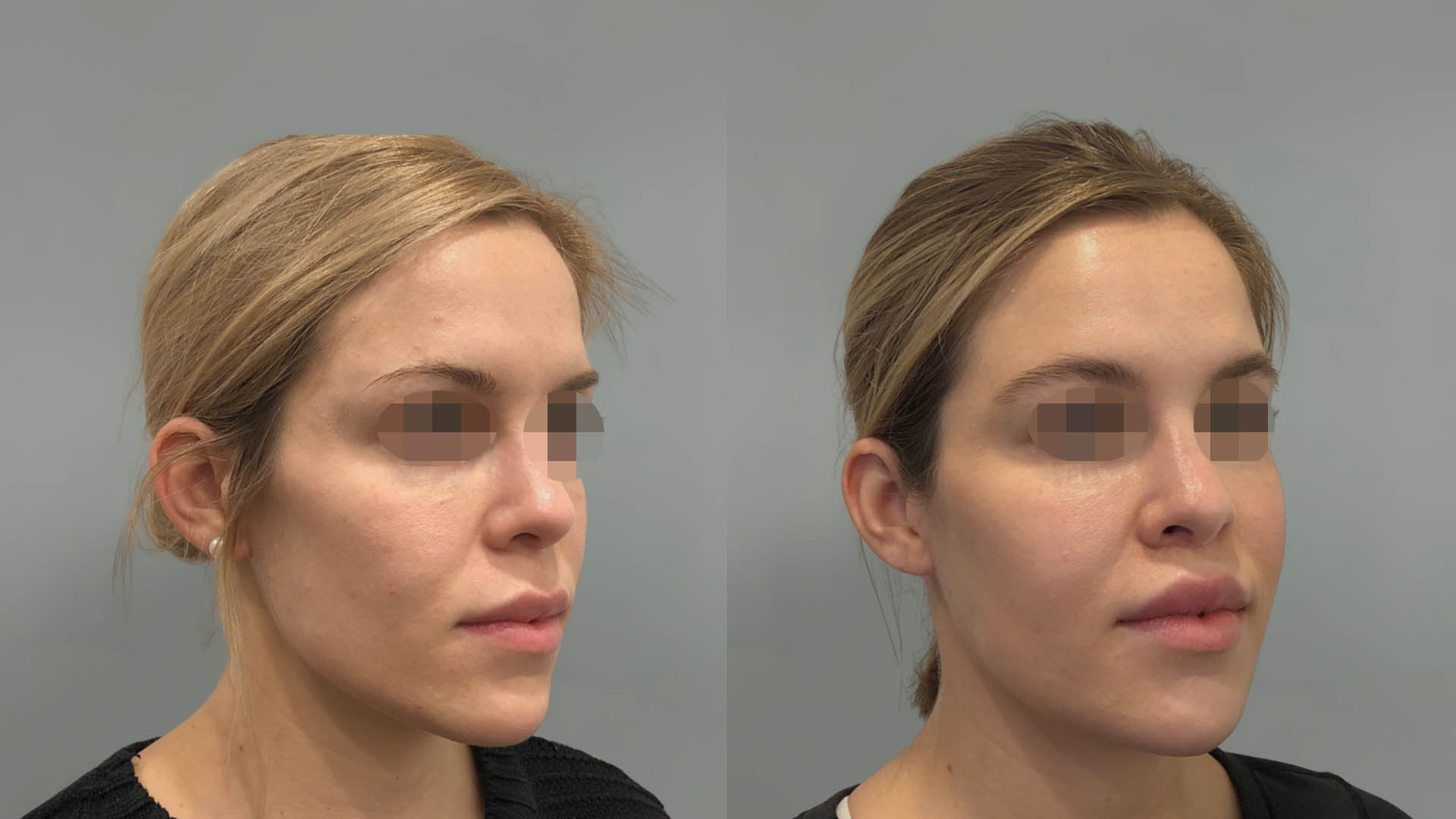 LMM_SideBySide – 67