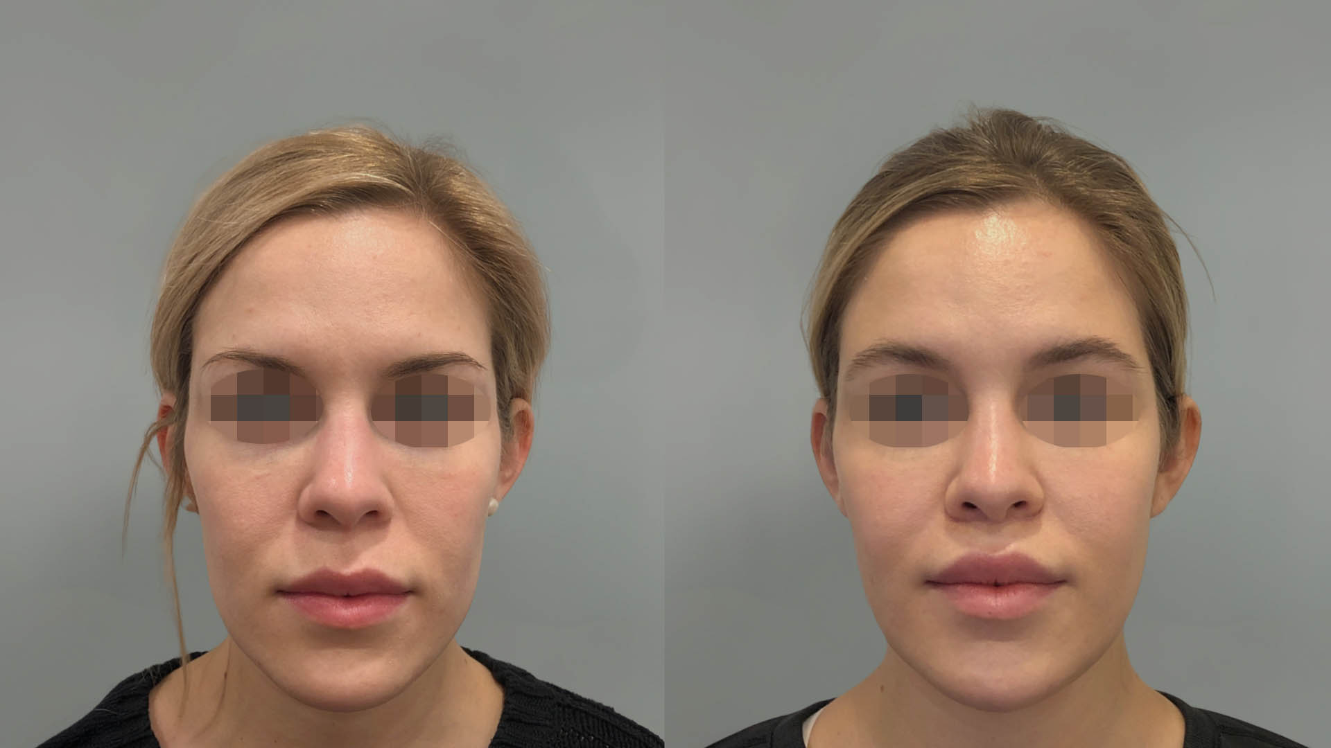 LMM_SideBySide – 67