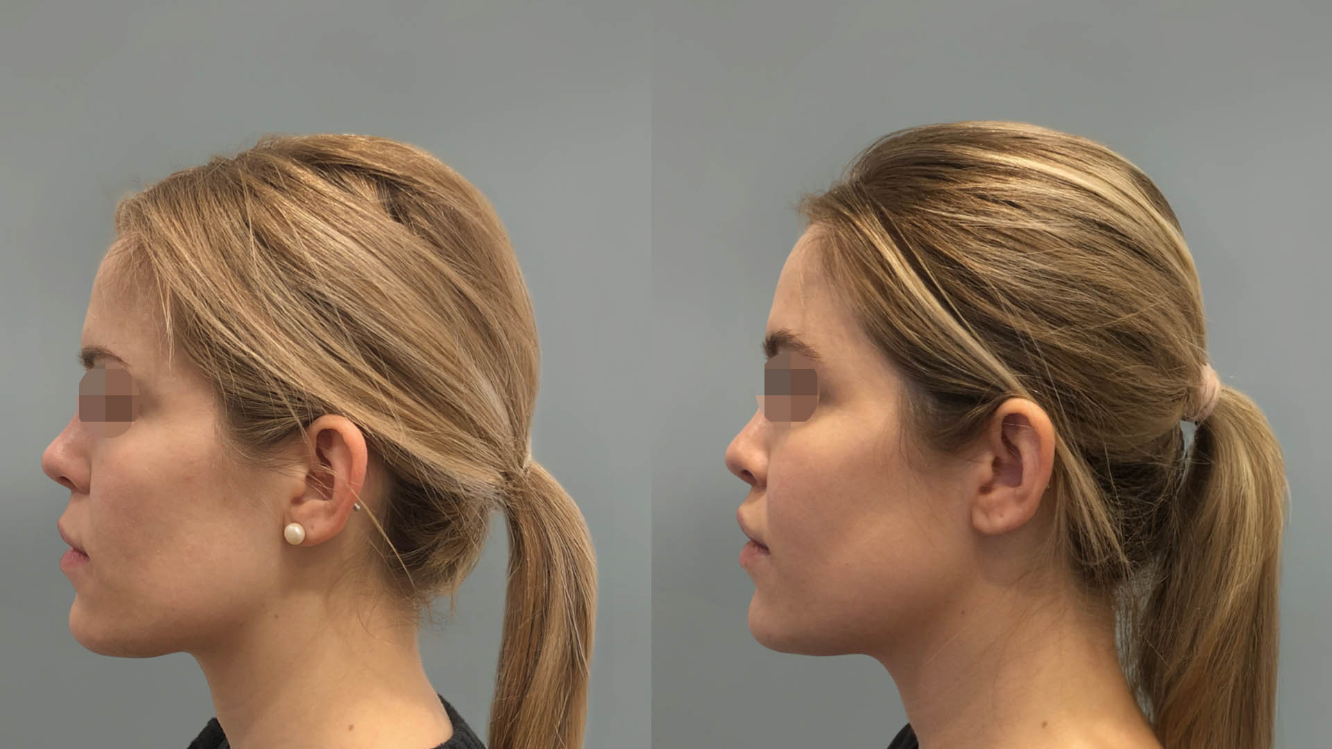 LMM_SideBySide – 67