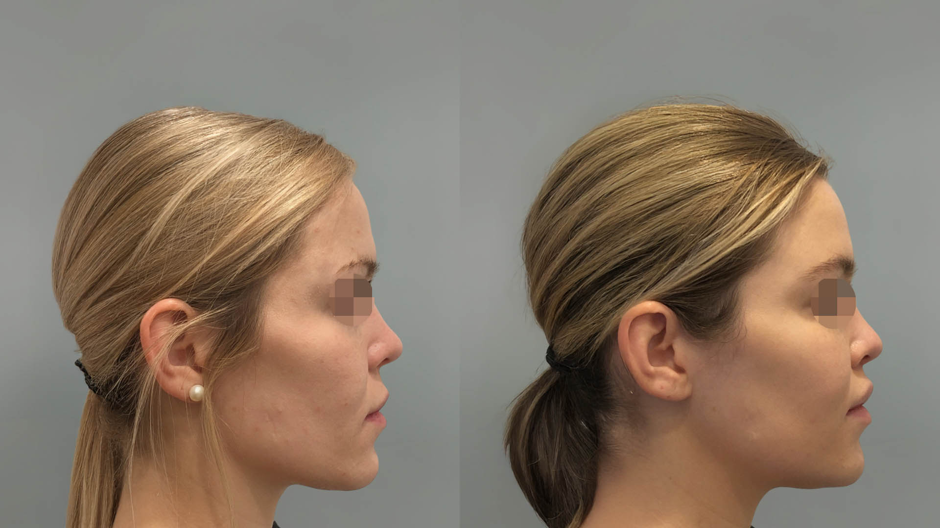 LMM_SideBySide – 67