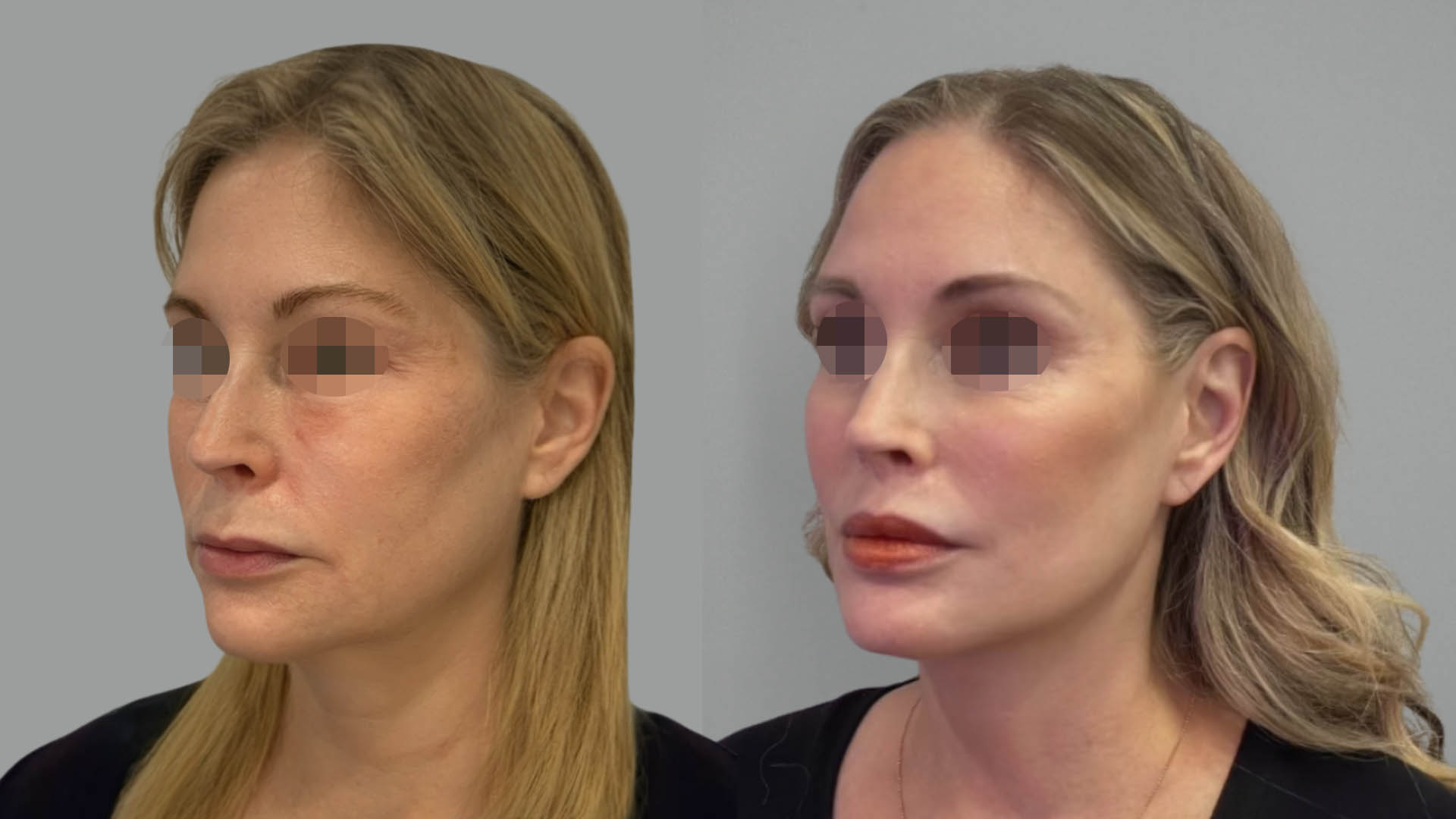 LMM_SideBySide – 67