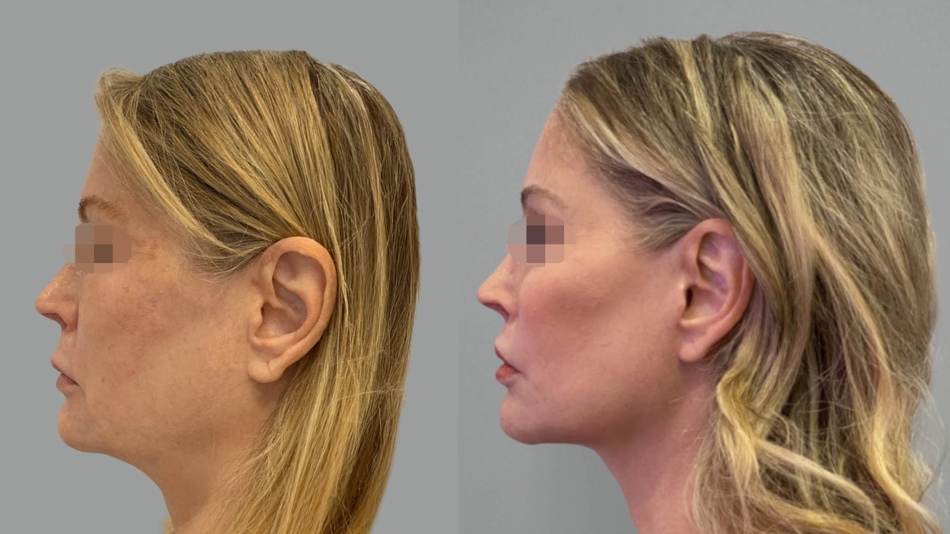 LMM_SideBySide – 67