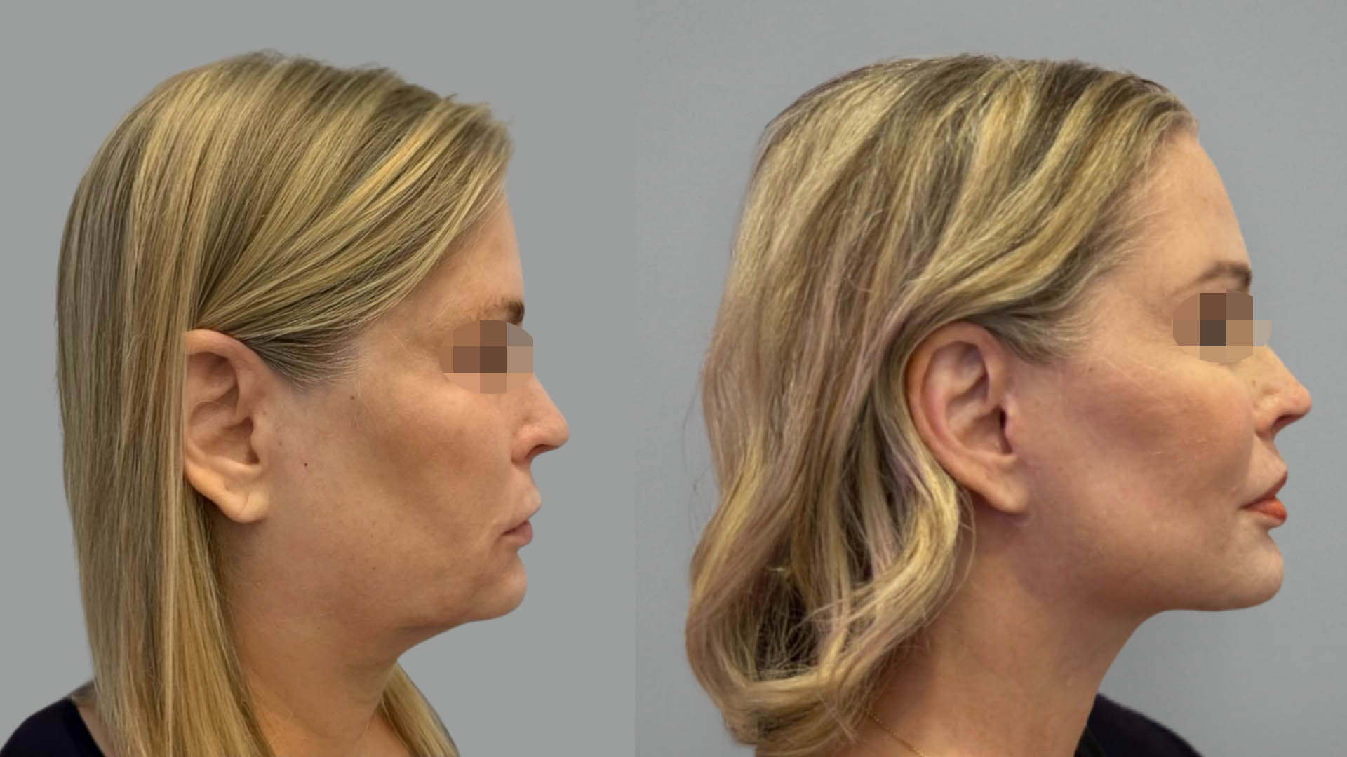 LMM_SideBySide – 67