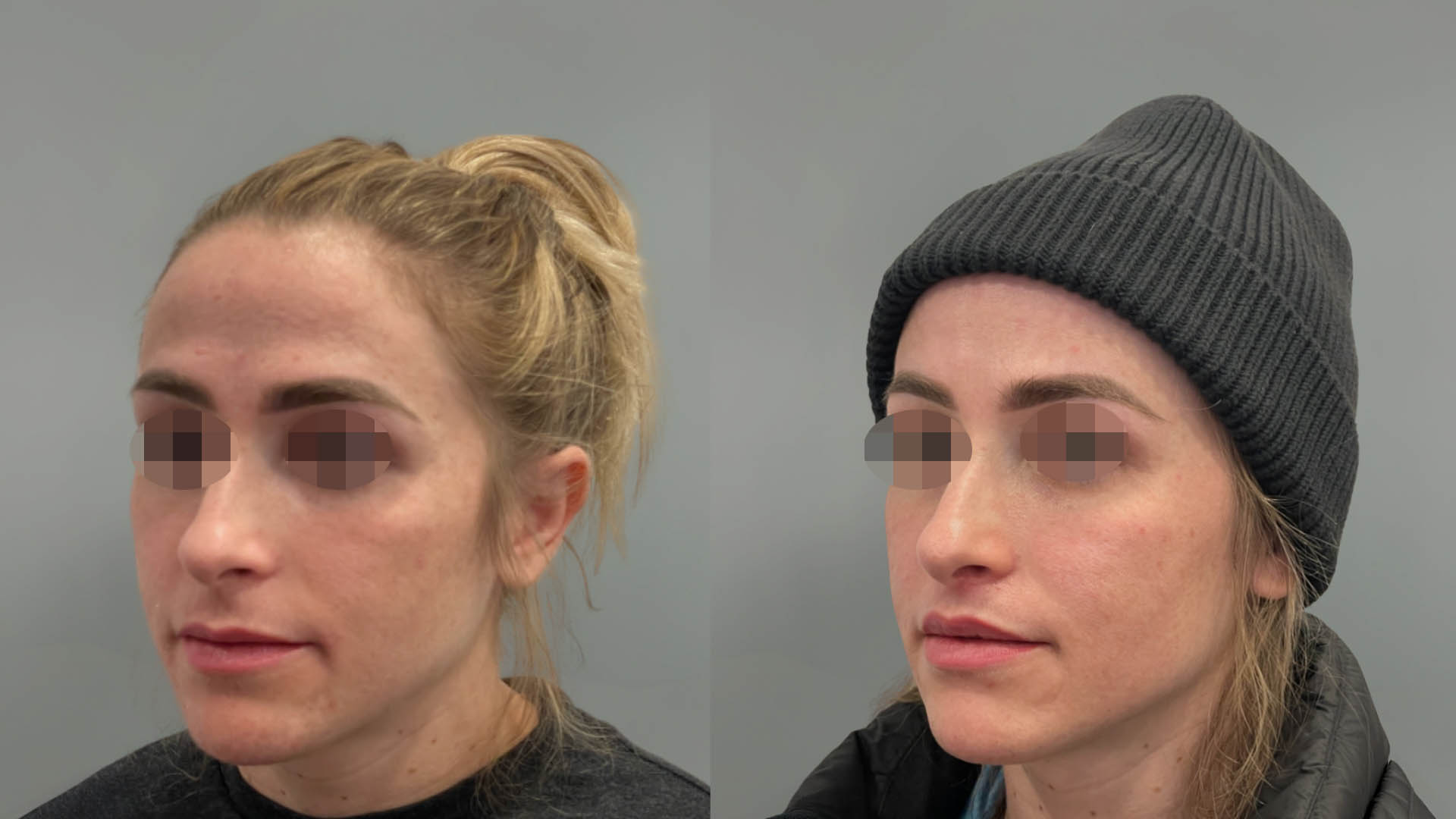 LMM_SideBySide – 67