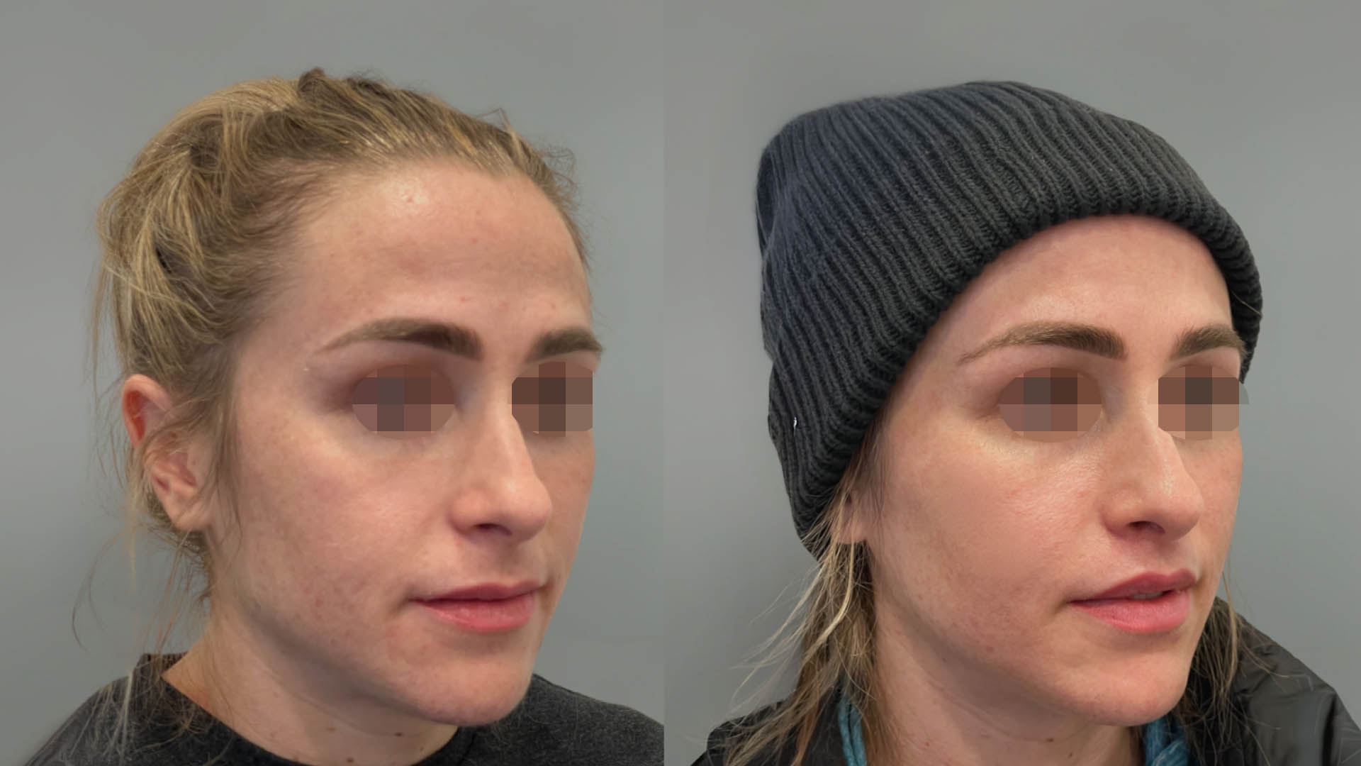 LMM_SideBySide – 67