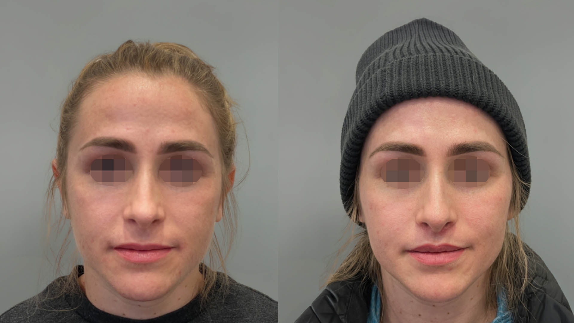 LMM_SideBySide – 67