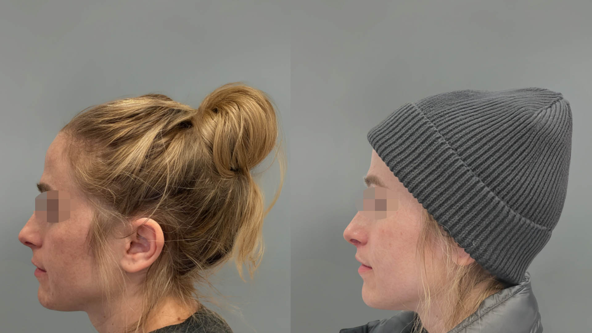 LMM_SideBySide – 67