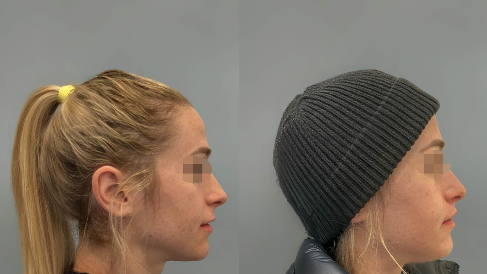 LMM_SideBySide – 67