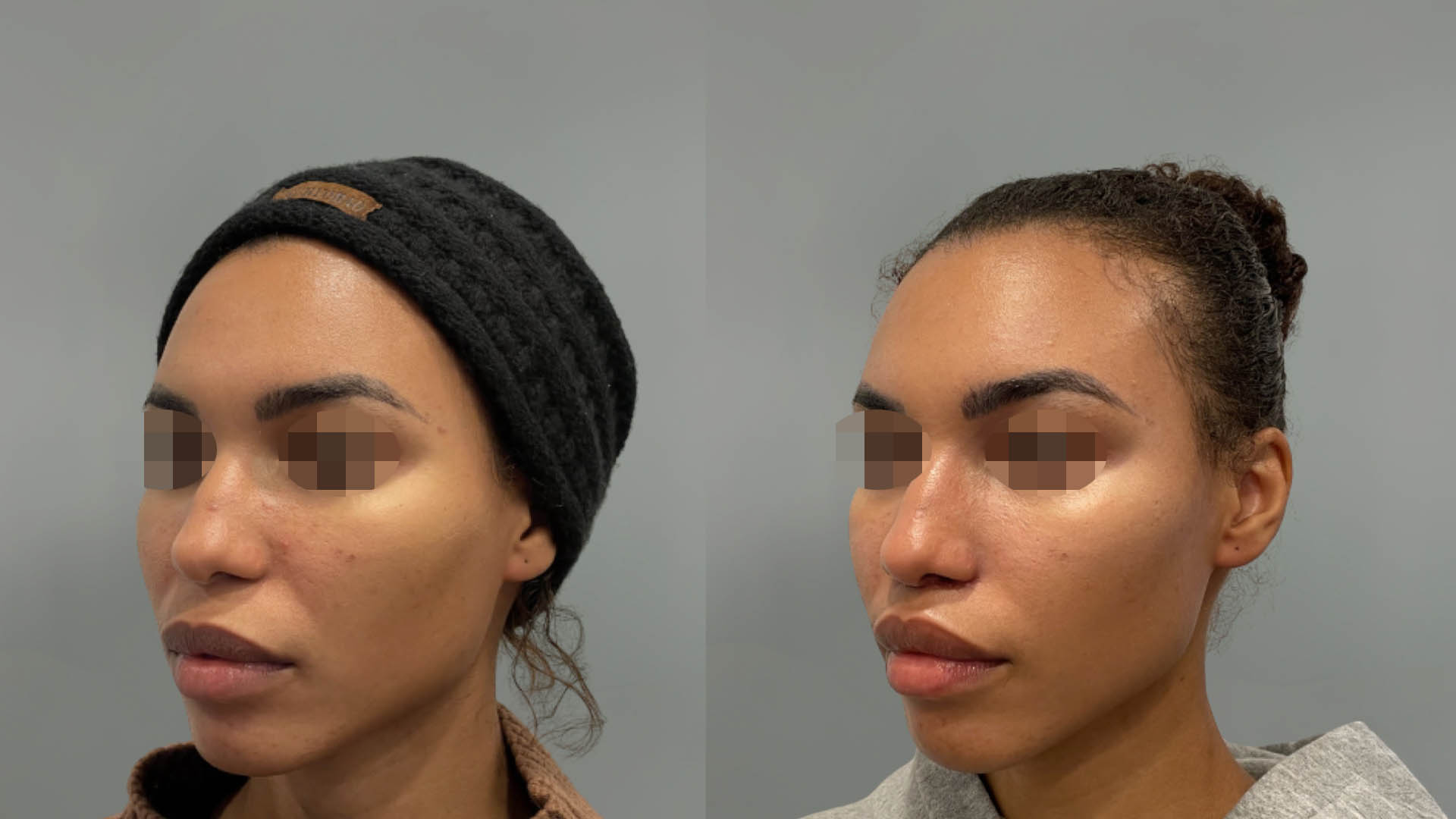 LMM_SideBySide – 67