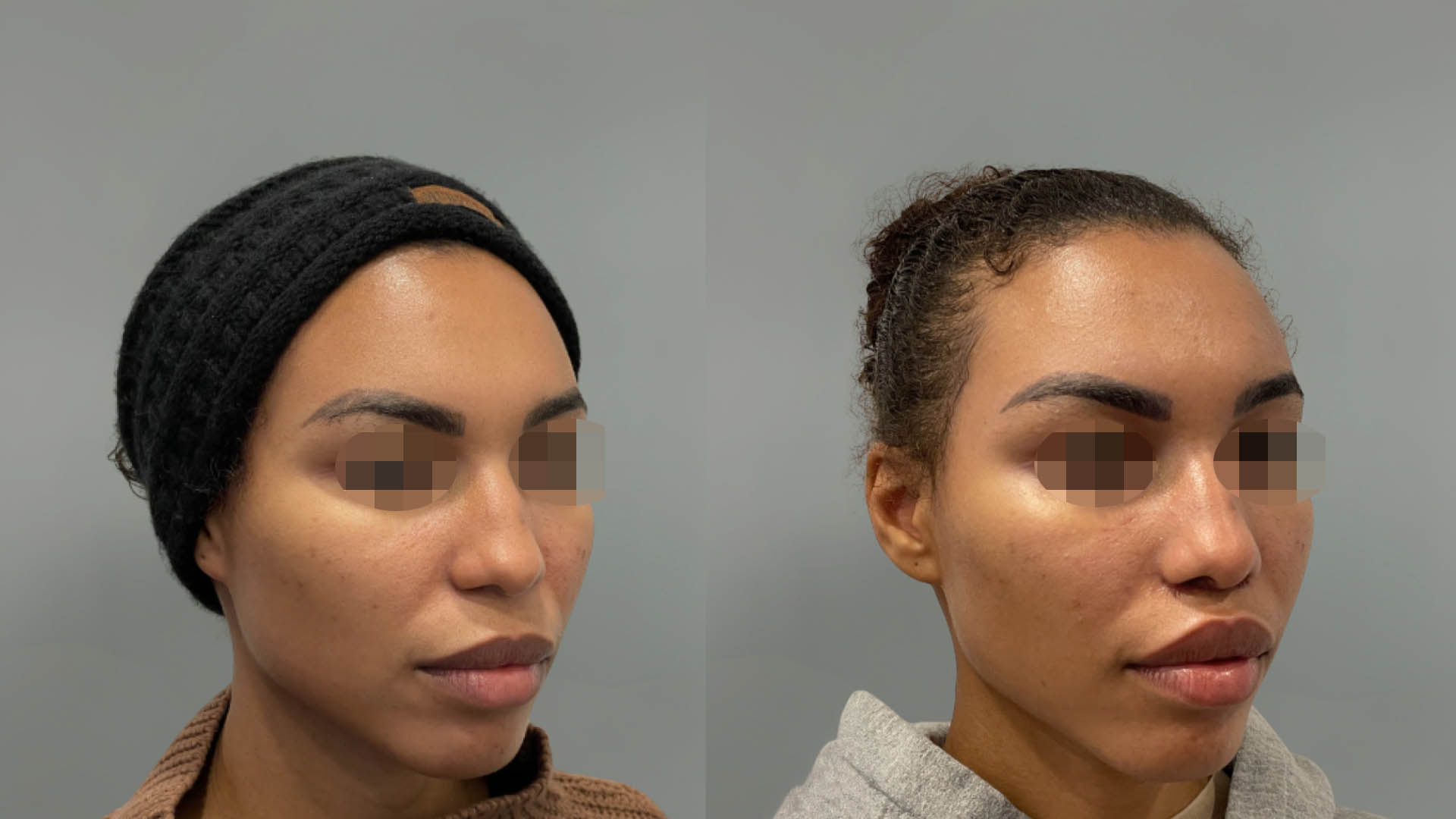 LMM_SideBySide – 67