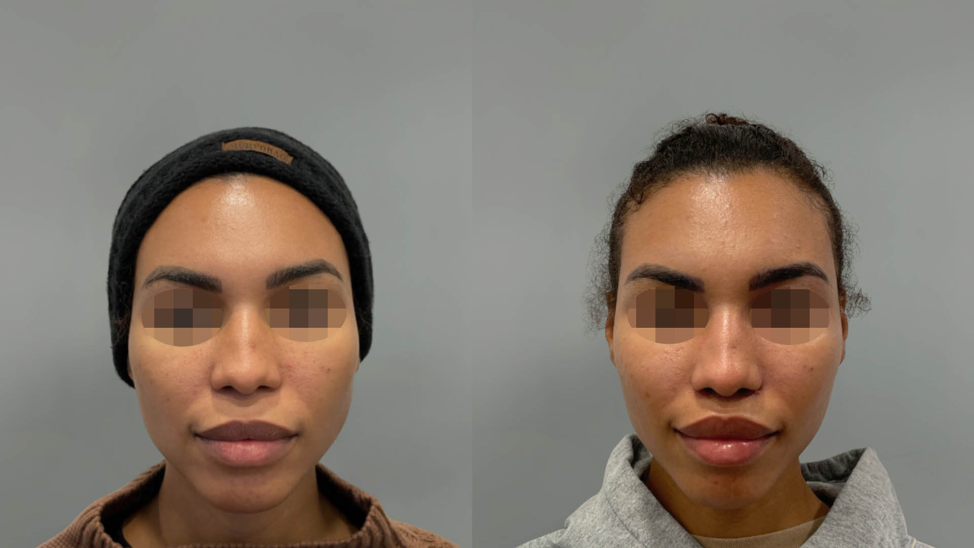 LMM_SideBySide – 67