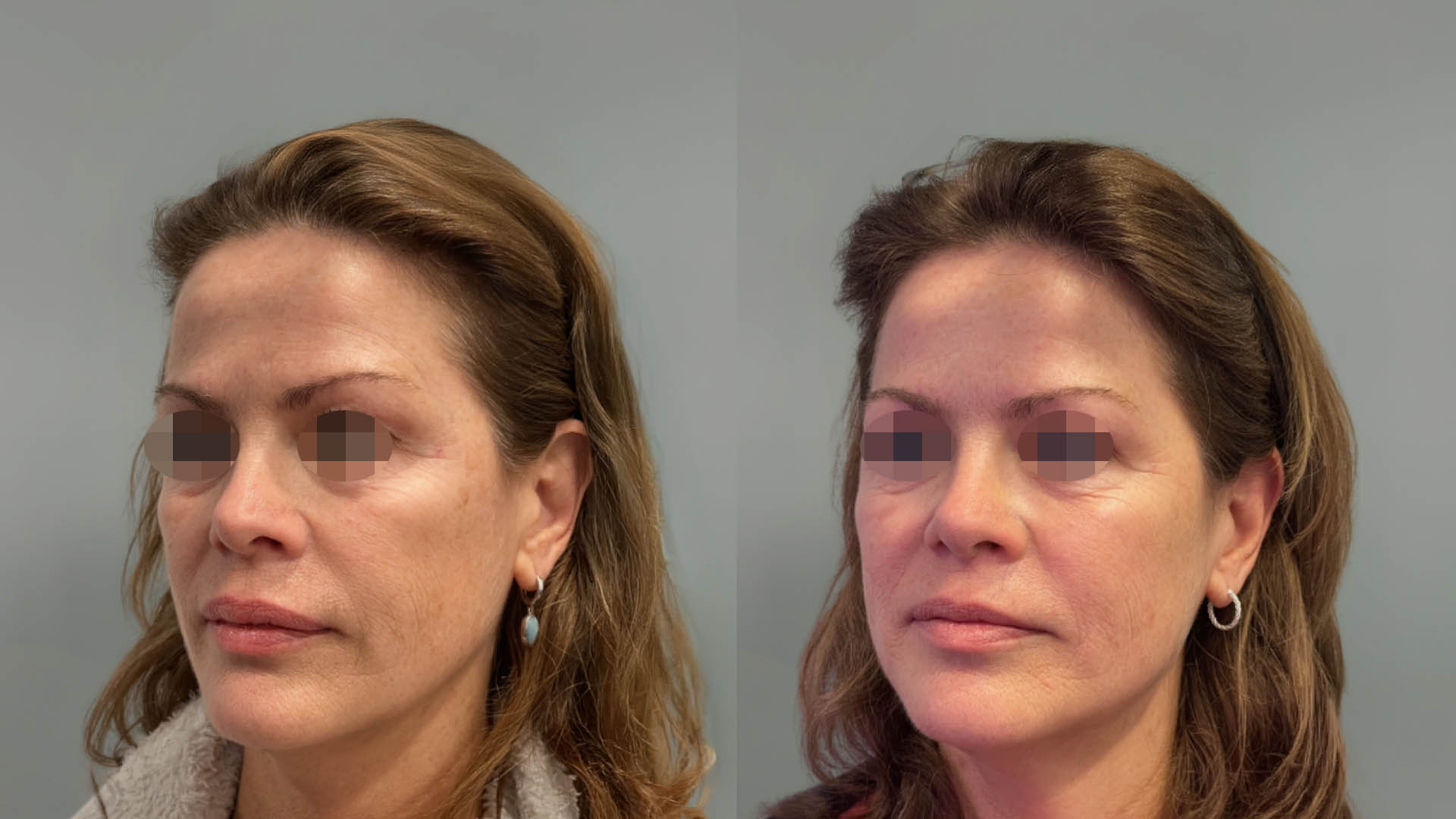 LMM_SideBySide – 67