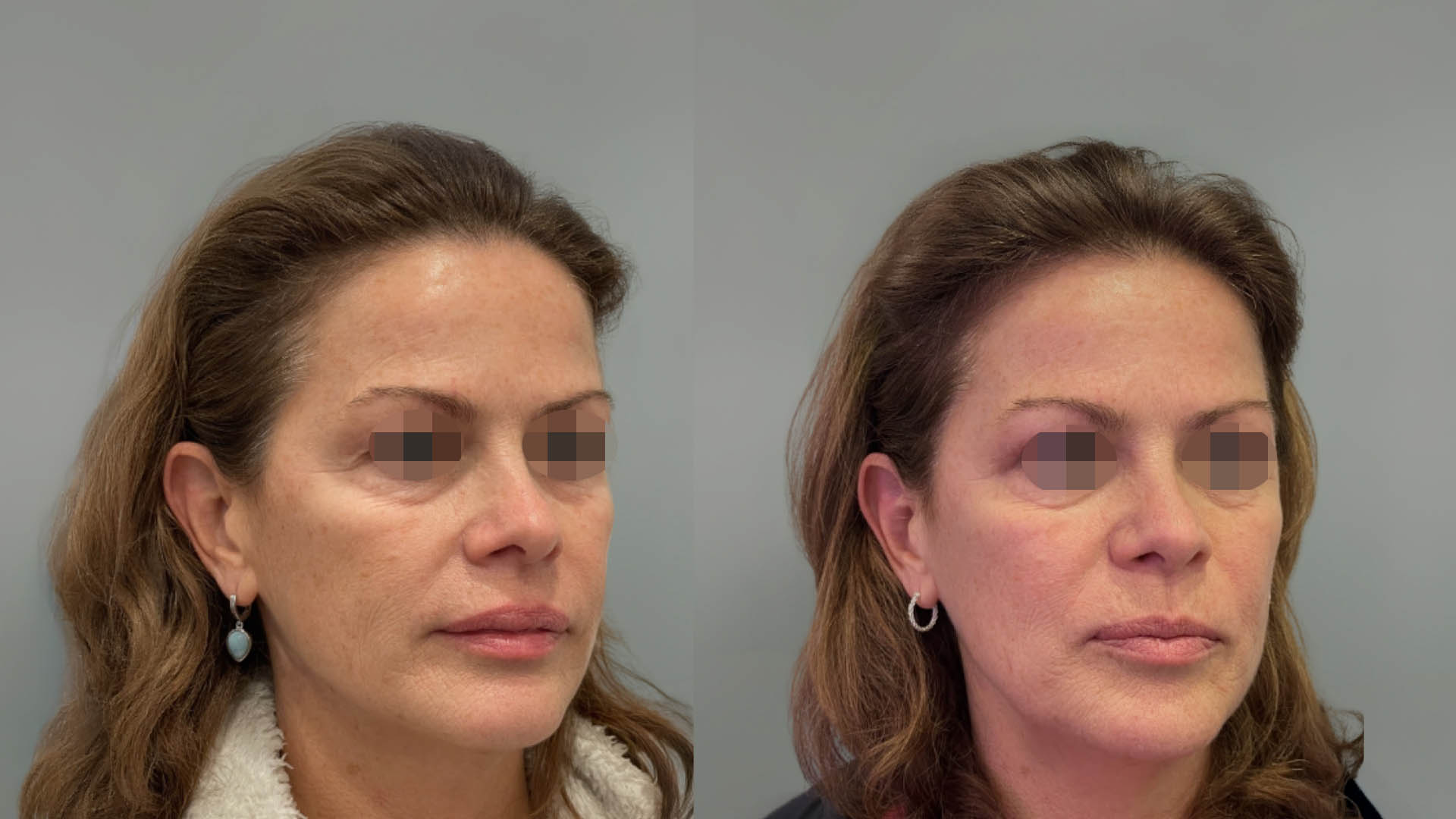 LMM_SideBySide – 67