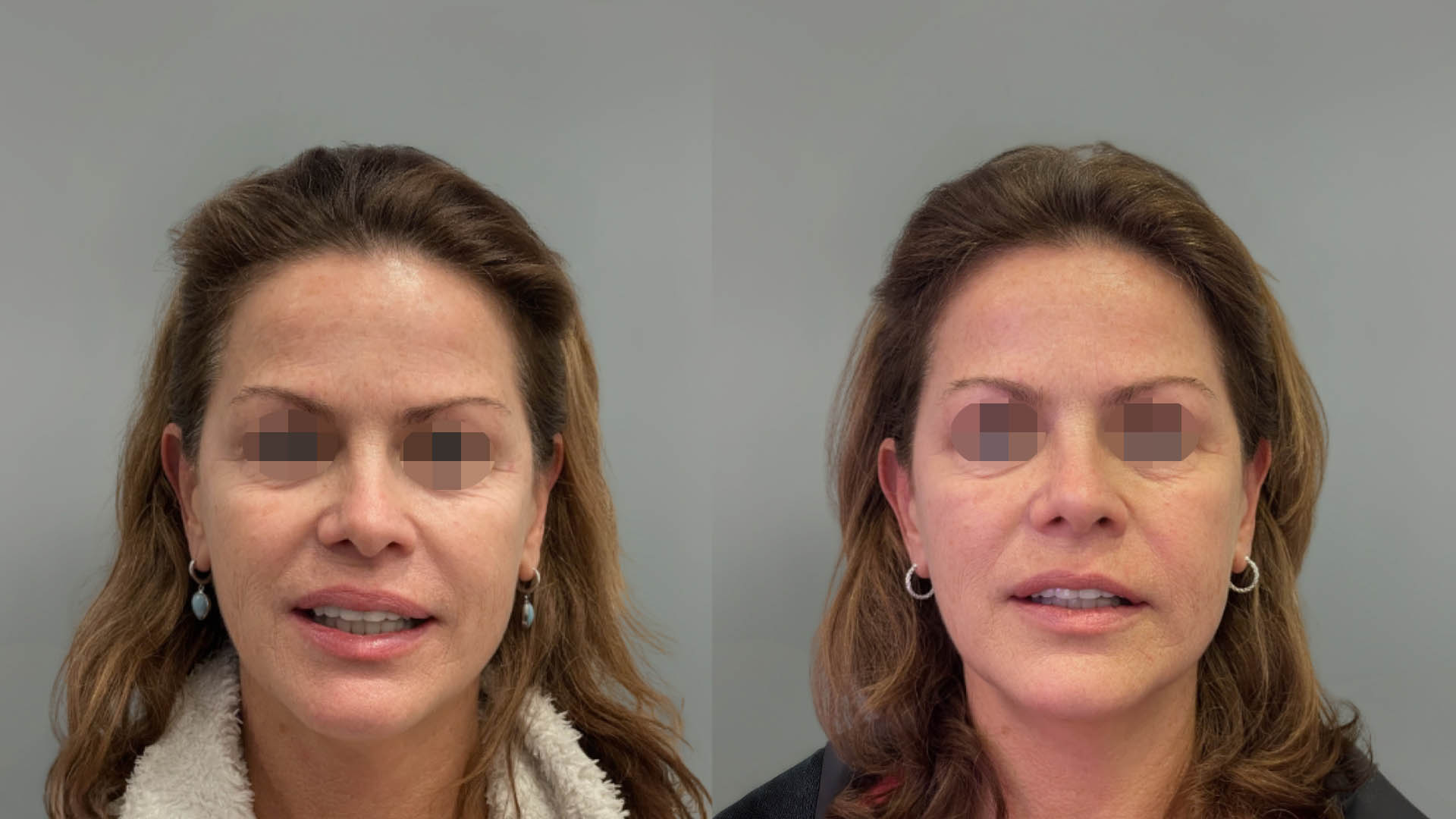 LMM_SideBySide – 67