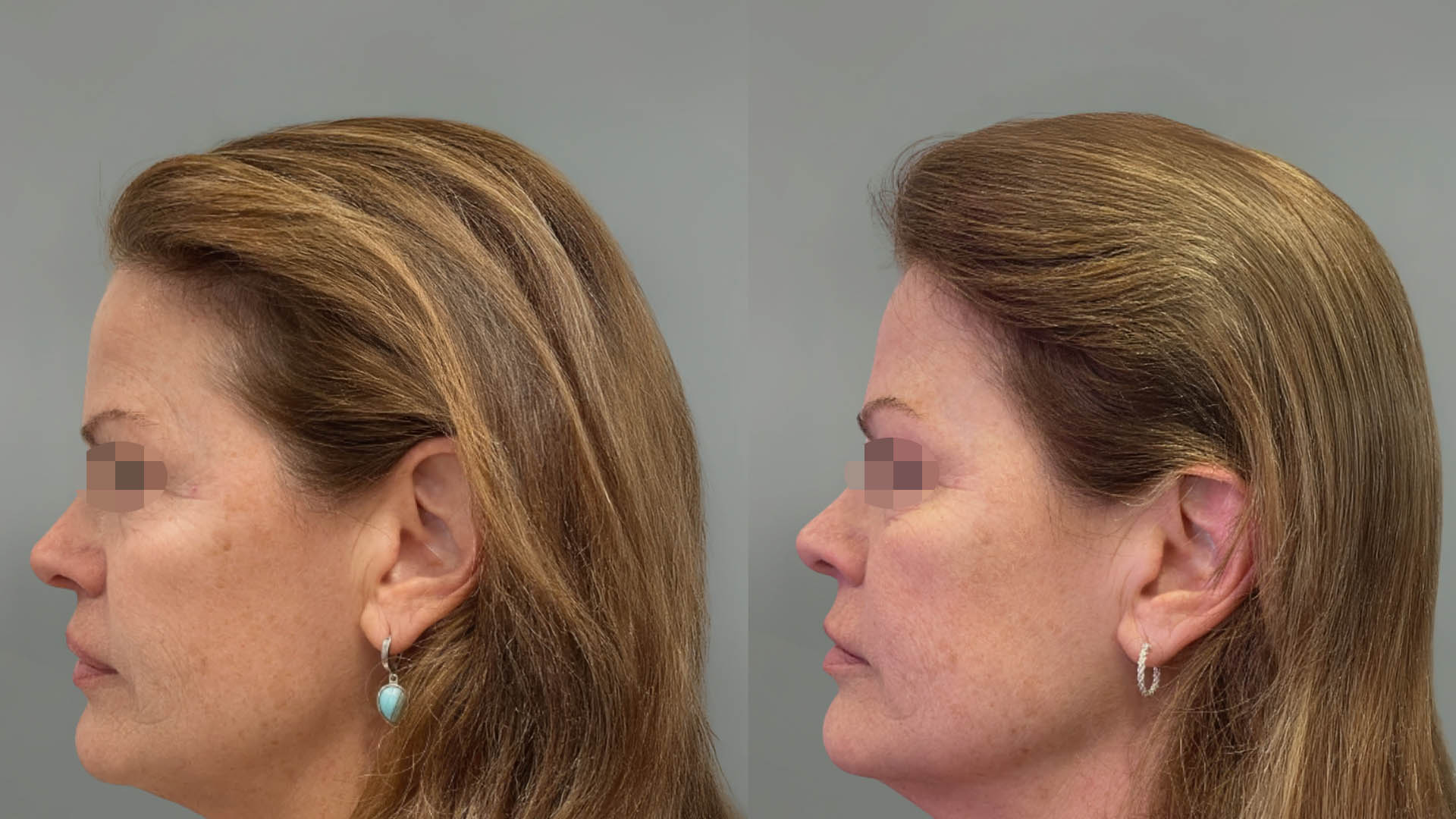 LMM_SideBySide – 67