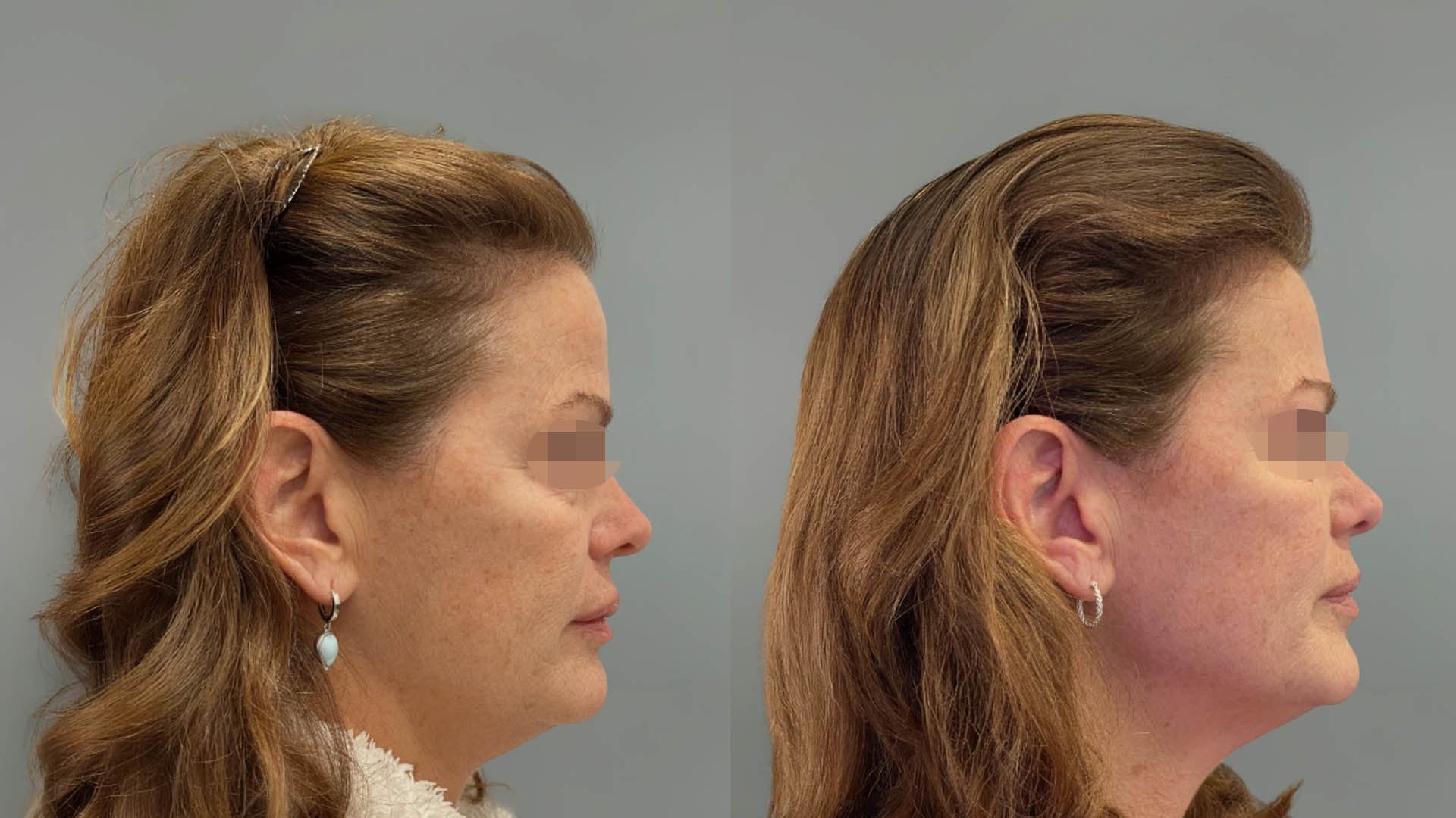 LMM_SideBySide – 67