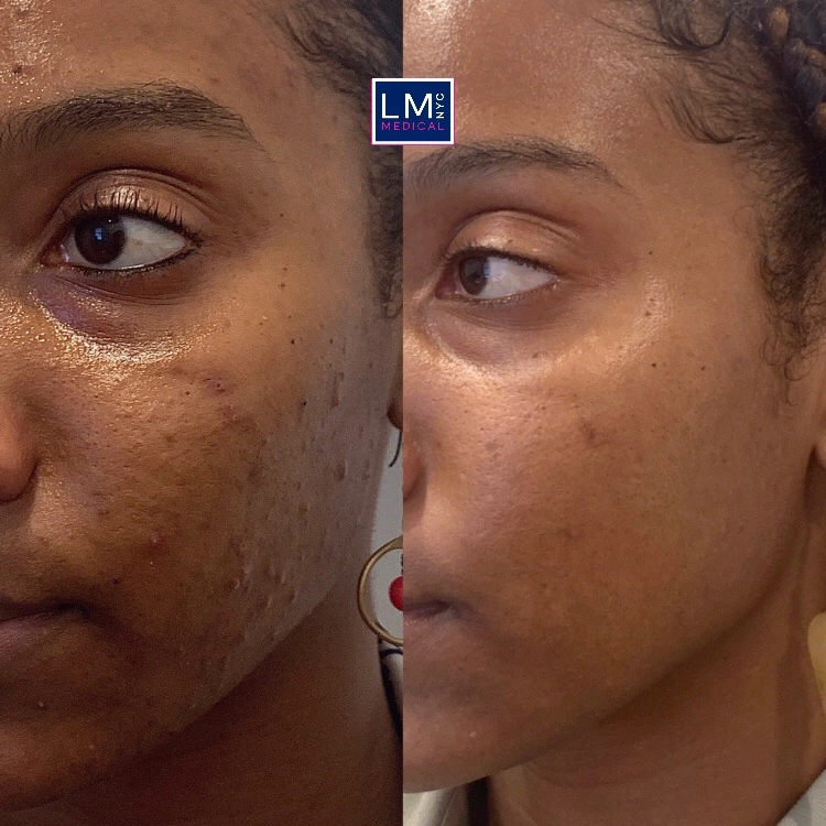 1CF93E4B-EDFD-494D-8335-3C0887DB4897