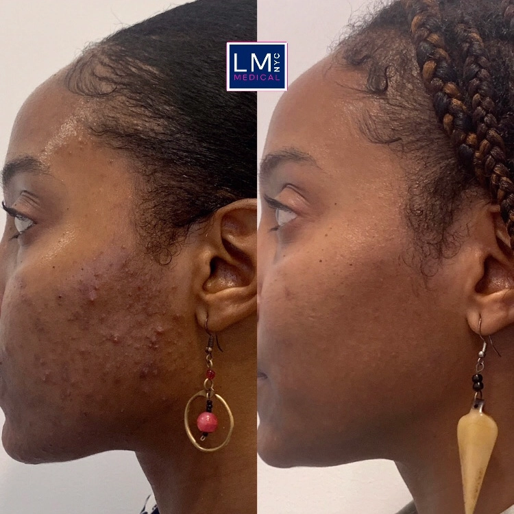 D27DD914-25F0-41F0-8078-E0BED8DDDF3A