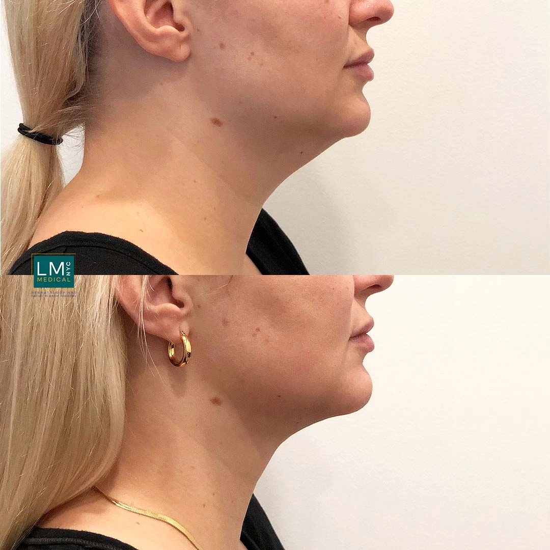 Image 3-16-21 at 11.40 PM