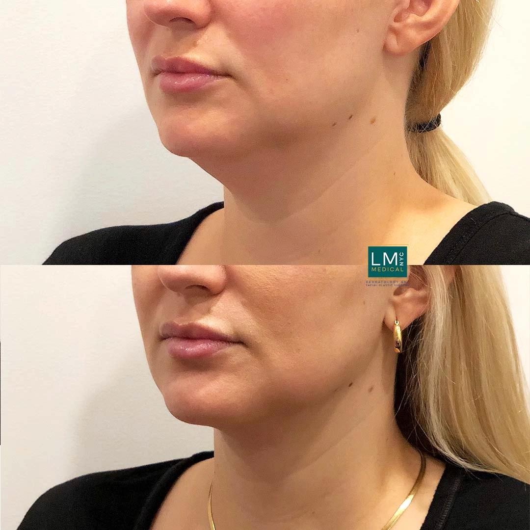 Image 3-16-21 at 11.41 PM (2)