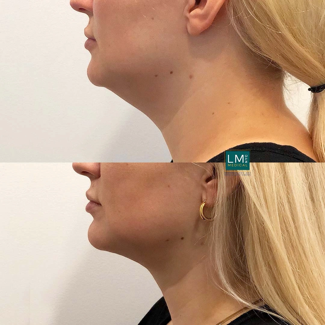 Image 3-16-21 at 11.42 PM (1)