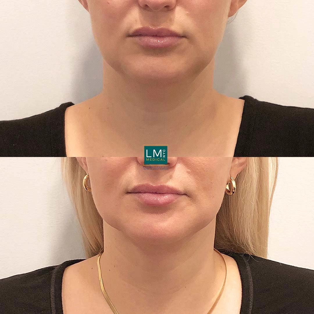 Image 3-16-21 at 11.48 PM (1)