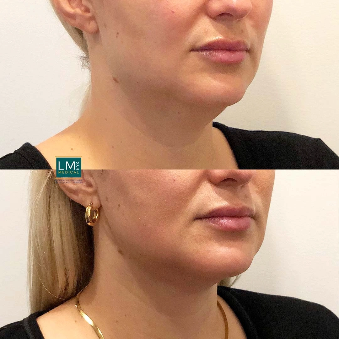 Image 3-16-21 at 11.49 PM