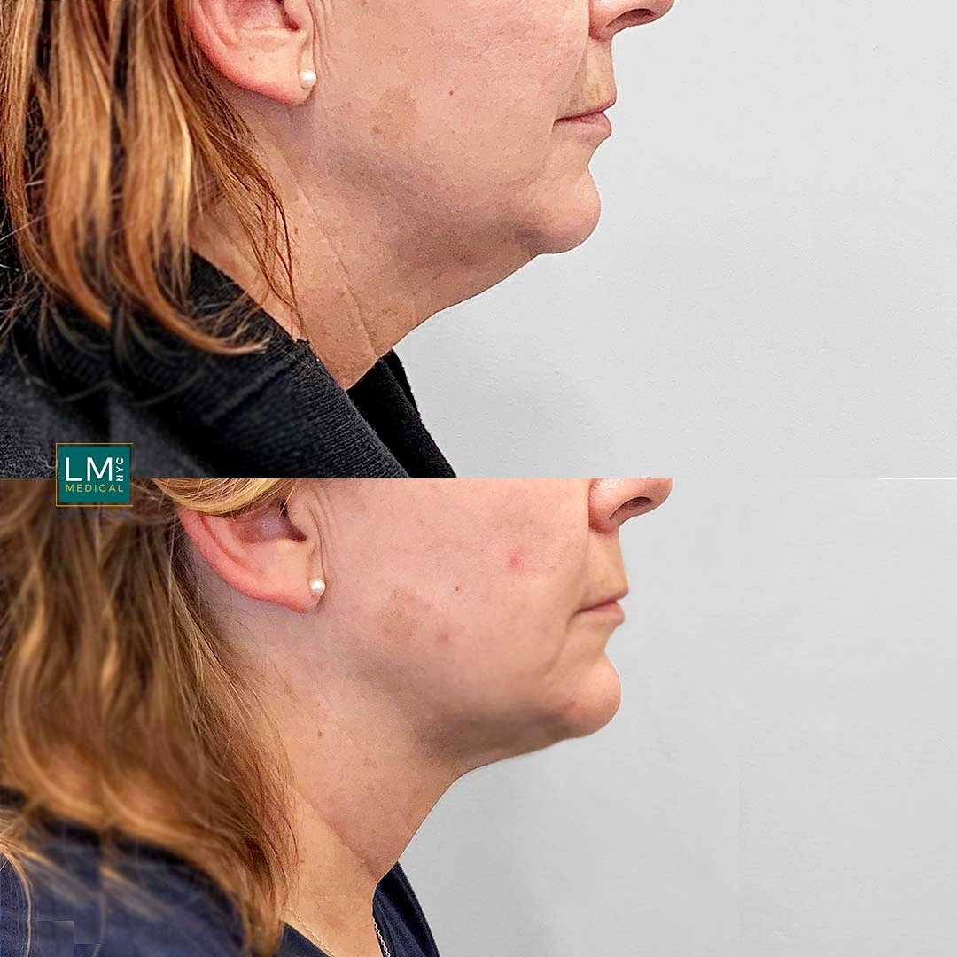 Image 3-21-21 at 12.52 PM