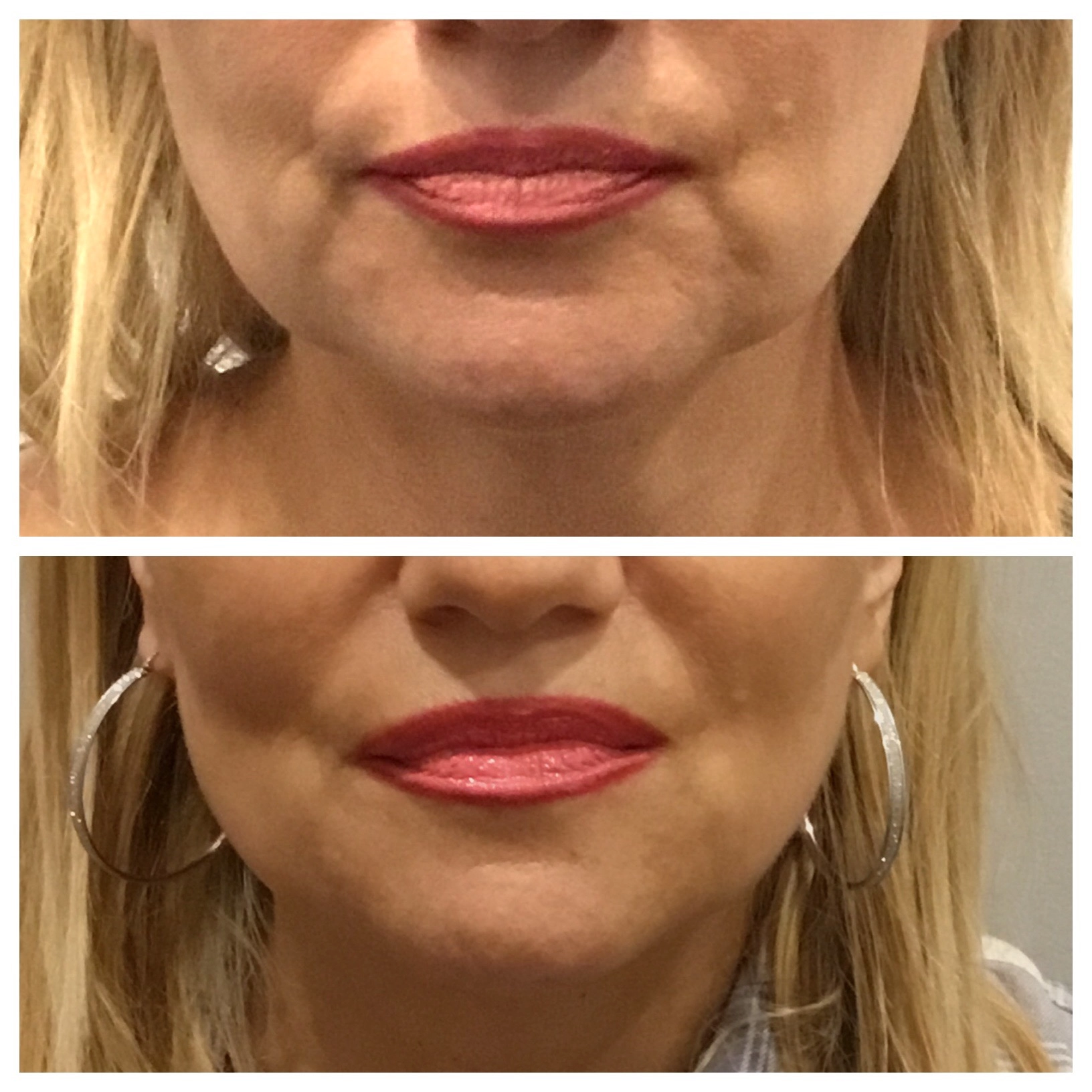 marionettelinefiller1